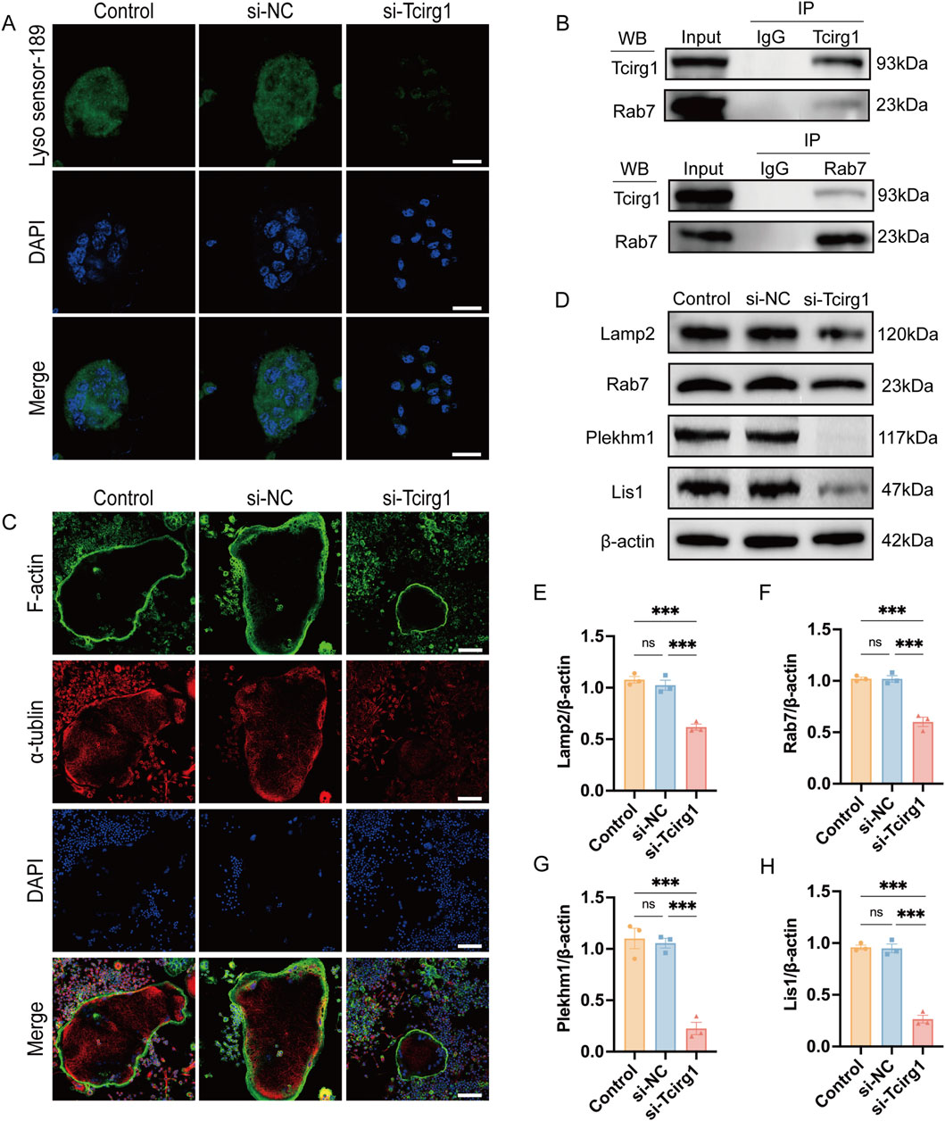 Fluorescence microscopy and Western blot analysis images showing cellular and molecular changes under control, si-NC, and si-Tcirg1 conditions. Panels A and C depict fluorescence microscopy of cells stained with Lyso sensor-189, DAPI, F-actin, and alpha-tubulin, each with merged images. Panel B shows co-immunoprecipitation results for Tcirg1 and Rab7 proteins. Panel D displays Western blot results for Lamp2, Rab7, Plekhm1, Lis1, and beta-actin proteins. Graphs E to H present quantitative analyses, illustrating the relative expression levels of Lamp2, Rab7, Plekhm1, and Lis1 normalized to beta-actin, with significant differences indicated.