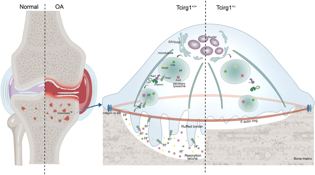 Illustration showing a comparison of normal and osteoarthritic (OA) bone structure alongside a detailed cross-section of an osteoclast cell. The left side depicts healthy bone structure with intact cartilage, while the right side shows osteoarthritic bone with degraded cartilage and enlarged osteoclast presence. The cell diagram highlights components like the nuclei, ER/Golgi, and secretory lysosomes, emphasizing proteins such as integrin, Mmp9, and Ctsk, contributing to bone resorption. The ruffled border and F-actin ring are also labeled, showing the cell's interaction with the bone matrix.