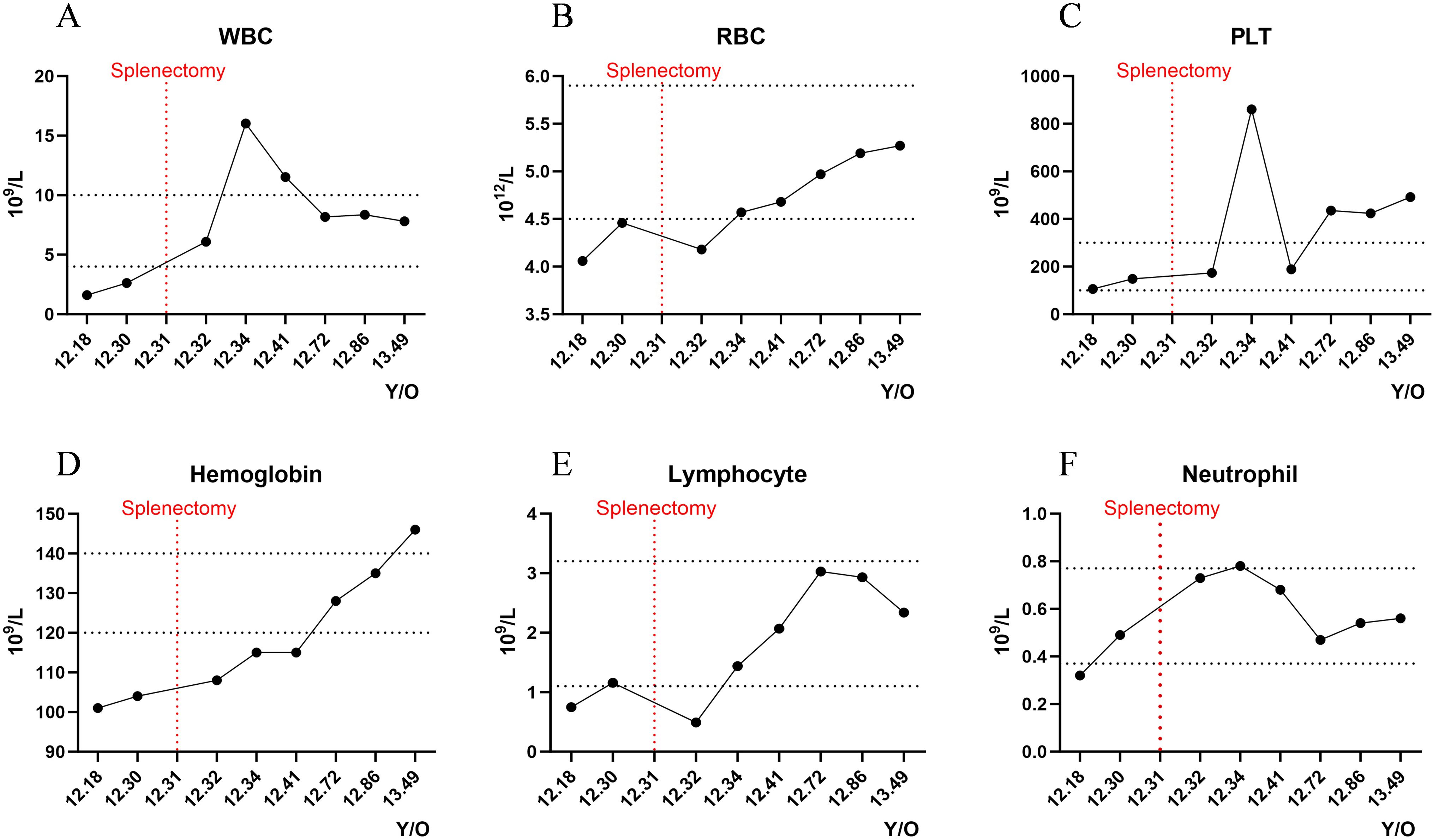 Dynamic changes in blood parameters before and after splenectomy at 12.31 years of age. A: WBC levels stabilize within the normal range after surgery. B: RBC levels increase steadily. C: PLT levels peak sharply post-surgery and subsequently normalize. D: Hemoglobin levels increase steadily. E: Lymphocyte counts increase and stabilize within the normal range. F: Neutrophil counts peak post-surgery and stabilize within the normal range. All charts use Y/O on the x-axis and the corresponding units for each parameter on the y-axis.