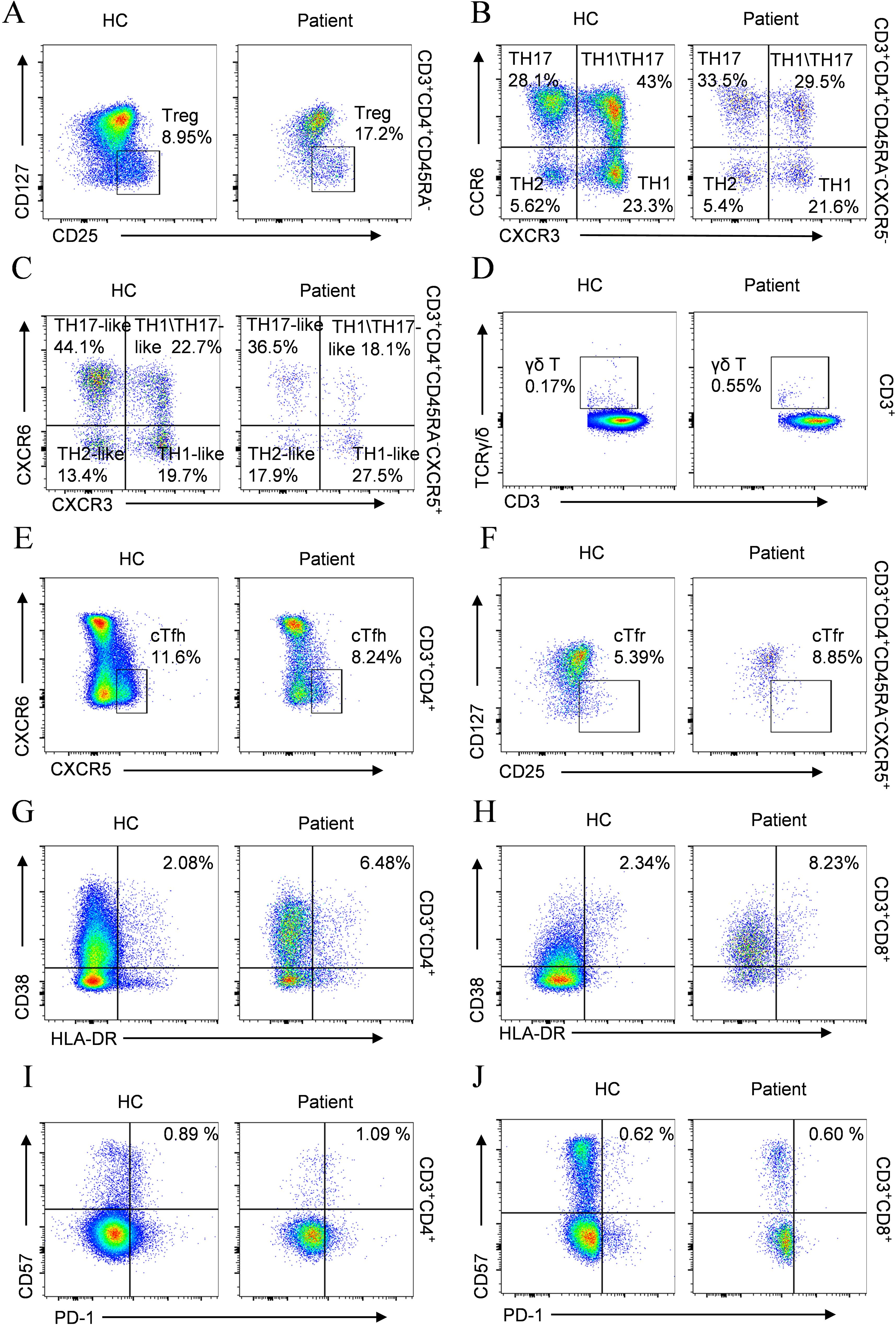 Flow cytometry dot plot analysis of T cell subset phenotyping in the patient compared with age-matched healthy controls (HC). Flow cytometry analysis reveals distinct alterations in T cell subsets. Panel A shows a significant expansion of Tregs. Panel B depicts a marked increase in classical Th17 cells accompanied by a concomitant reduction in Th1/Th17 populations. Panel C presents cTfh cell subsets, demonstrating reduced TH1-like, TH2-like, and TH17-like cTfh populations. Panel D indicates a marked increase in γδ T lymphocytes. Panel E illustrates aberrant activation of cTfh cells, while Panel F depicts increased cTfr cells. Panel G shows an elevated frequency of activated CD4⁺ T cells, and Panel H demonstrates an elevated frequency of activated CD8⁺ T cells. Panel I reveals a markedly increased frequency of exhausted CD4⁺ T cells, whereas Panel J shows no significant difference in exhausted CD8⁺ T cells.