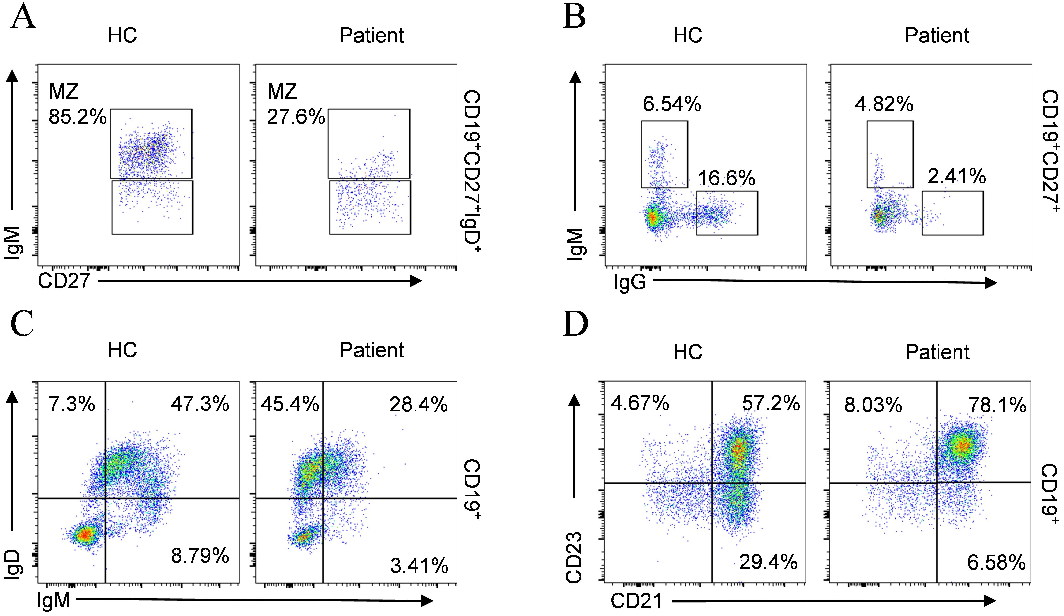 Flow cytometry dot plot analysis of B cell subset phenotyping in the patient compared with age-matched healthy controls (HC). Flow cytometry analysis reveals distinct alterations in B cell subsets. Panel A shows a significant decrease in the percentage of marginal zone (MZ) B cells in the patient. Panel B displays an increase in the percentage of IgM⁺ B cells. Panel C depicts an increase in the percentage of IgD⁺IgM⁻ B cells and a decrease in the percentage of IgD⁺IgM⁺ B cells. Panel D illustrates an increase in the percentage of CD23⁺CD21⁺ B cells and a decrease in the percentage of CD23⁻CD21⁺ B cells.