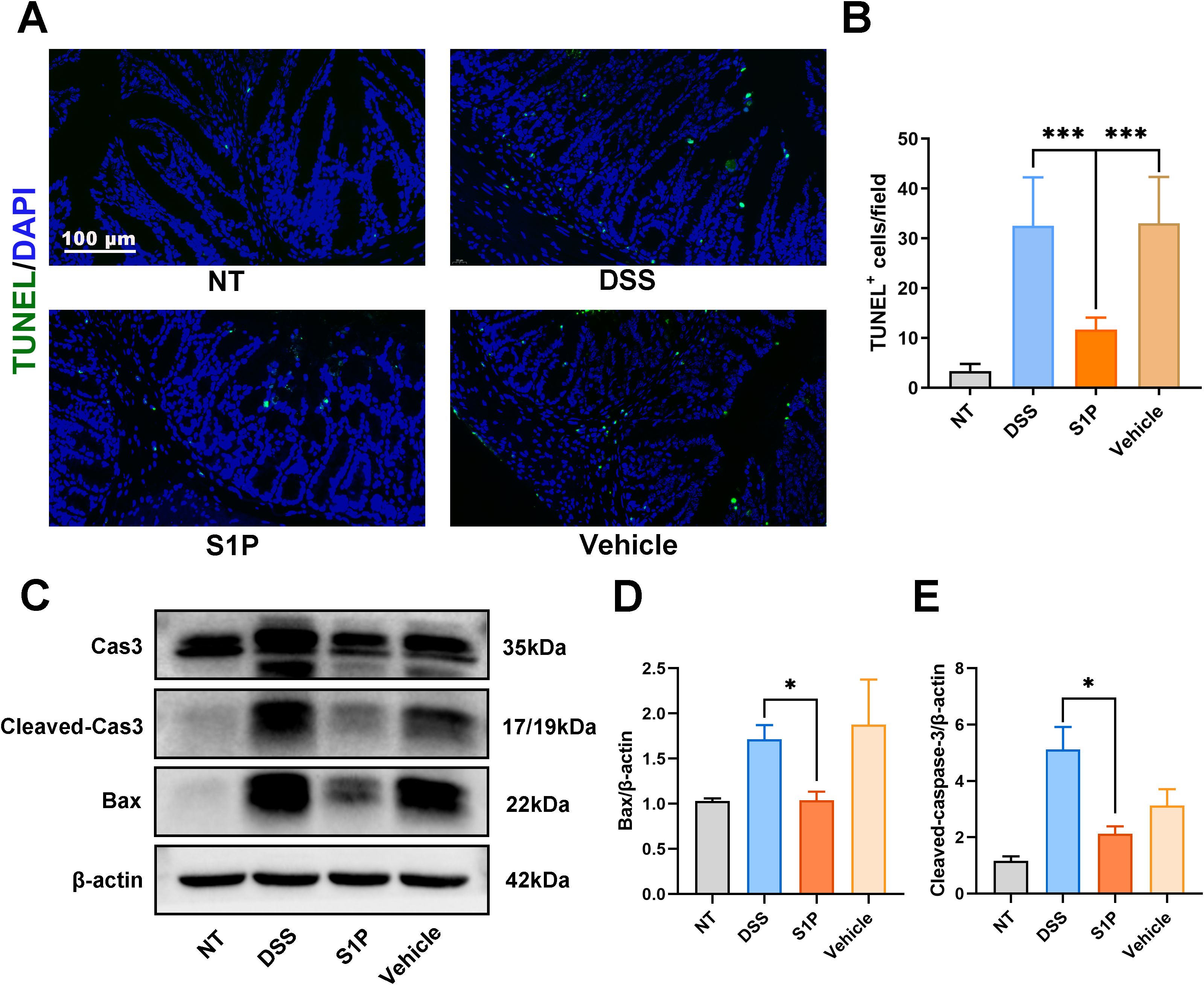 (A) Four panels of colon tissue sections stained with TUNEL (green) and DAPI (blue) show varying levels of apoptosis under NT, DSS, S1P, and Vehicle treatments. (B) Bar graph representing the number of TUNEL-positive cells per field, with significant increases in DSS and Vehicle compared to S1P. (C) Western blot showing expression levels of Cas3, Cleaved-Cas3, Bax, and β-actin in different treatment groups. (D) Bar graph of Bax normalized to β-actin, with a notable increase in DSS and Vehicle. (E) Bar graph of Cleaved-Cas3 normalized to β-actin, highlighting differences across treatments.
