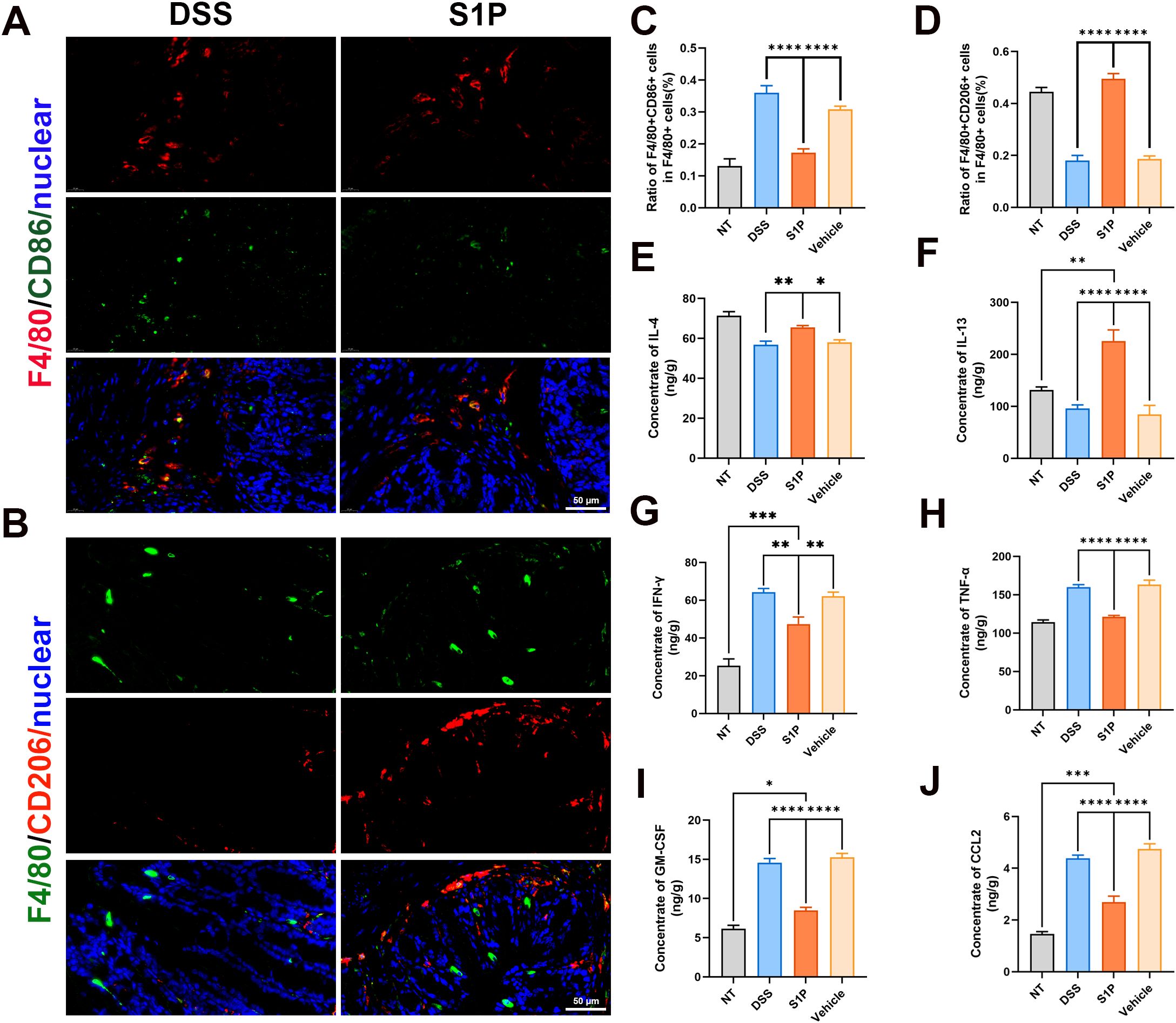 Fluorescence microscopy images and bar graphs demonstrate the effects of DSS and S1P on immune cell markers and cytokine concentrations. Panels A and B show F4/80, CD86, and CD206 staining on tissue sections treated with DSS or S1P. Panels C to J feature bar graphs depicting the percentage of specific cells and concentrations of IL-4, IL-13, IFN-γ, TNF-α, GM-CSF, and CCL2 among different treatment groups (NT, DSS, S1P, Vehicle). The images include scale bars for size reference. Statistical significance is denoted by asterisks.