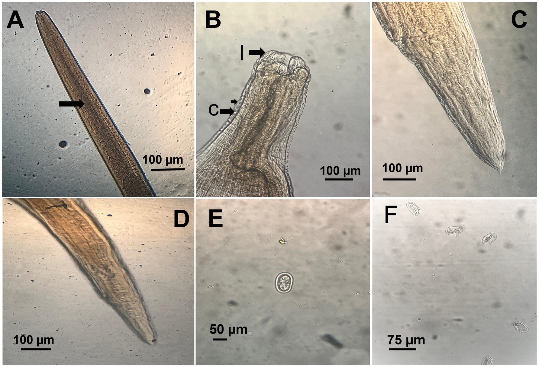 Photomicrographs labeled A to F show different magnified views of what appear to be parasitic organisms. Each panel has scale bars for size reference. Panels A, B, C, and D display elongated structures, likely nematodes, highlighted by arrows indicating specific features. Panels E and F exhibit smaller, rounded structures, possibly eggs or spores, each with its own scale for context.