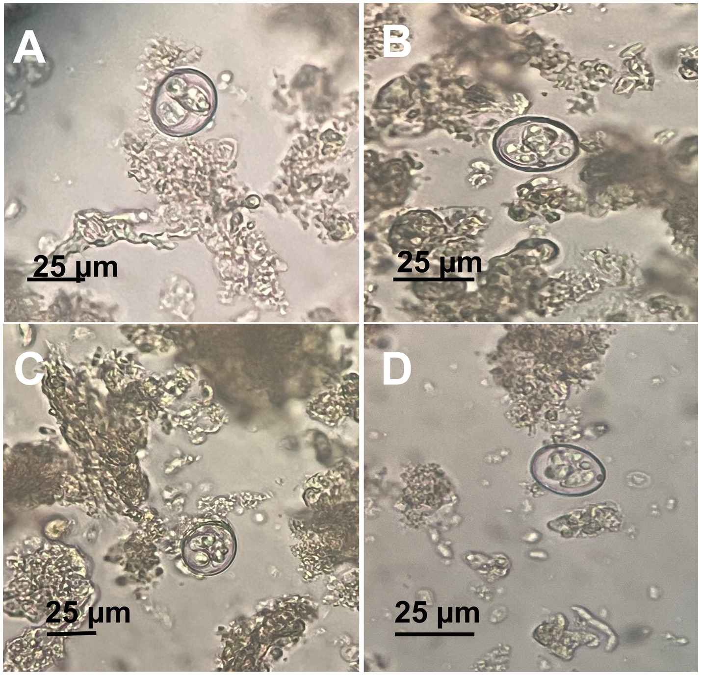 Microscopic images labeled A, B, C, and D, each showing small, circular organisms with complex structures inside, against a background of amorphous particles. Each image has a scale bar labeled 25 micrometers.