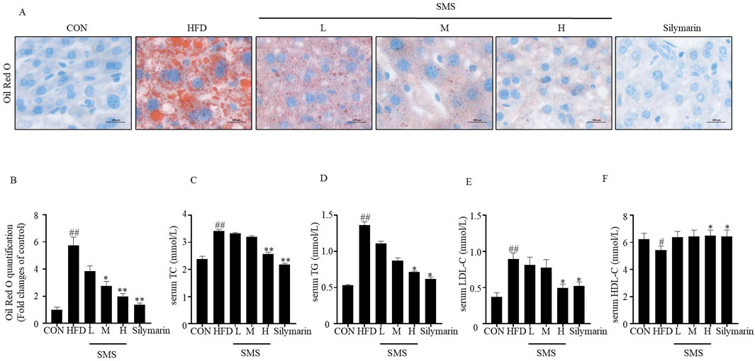 Histological liver sections and bar graphs analyze lipid accumulation and serum lipid profiles. Panel A shows Oil Red O staining with varying lipid content. Panels B to F display bar graphs quantifying Oil Red O, serum total cholesterol (TC), triglycerides (TG), low-density lipoprotein cholesterol (LDL-C), and high-density lipoprotein cholesterol (HDL-C) across different treatments, including control (CON), high-fat diet (HFD), and silymarin. Scale bars indicate 100 micrometers.