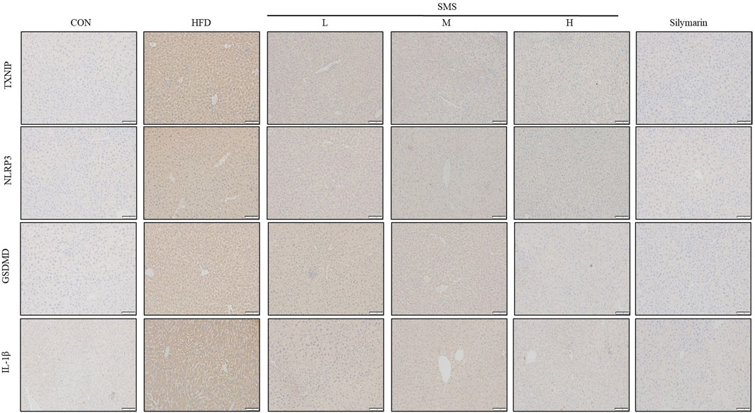 Microscopic images displaying liver tissue sections stained for markers TXNIP, NLRP3, GSDMD, and IL-1β across different treatment groups: CON, HFD, SMS at low (L), medium (M), and high (H) doses, and Silymarin. The sections show varying intensities of brown staining, indicating different levels of each marker expression among the groups.
