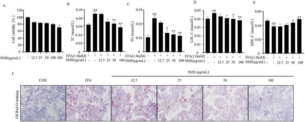 Graphs A to E show the effects of varying SMS concentrations on cell viability, total cholesterol, triglycerides, LDL-C, and HDL-C, with significant changes marked. Image F shows Oil Red O staining under different conditions: CON, FFA, and various SMS concentrations (12.5, 25, 50, 100 µg/mL), with visible differences in lipid accumulation.