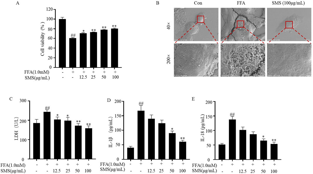 Composite image of five figures showing results of a scientific study. Panel A shows a bar graph of cell viability (%) with various concentrations of SMS and FFA. Panel B displays microscopic images at 40x and 200x magnifications for control, FFA, and SMS conditions, highlighting structural differences. Panel C illustrates a bar graph of LDH levels (U/L), and panels D and E show bar graphs of IL-1β and IL-18 levels (pg/mL), respectively, with varying SMS concentrations. All graphs show trends of increasing or decreasing levels depending on the treatments, with asterisks indicating statistical significance.