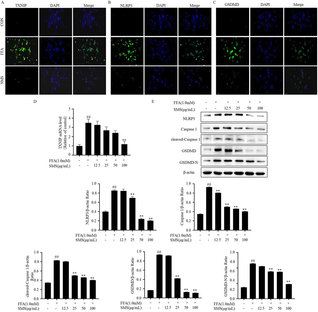 Fluorescence microscopy images and graphs depicting cellular responses. Panels A, B, and C show TXNIP, NLRP3, and GSDMD expression with DAPI-stained nuclei under different FFA and SMS treatments. Panel D presents bar graphs illustrating TXNIP mRNA levels and expression ratios, while panel E includes a Western blot analysis of proteins like NLRP3 and GSDMD under various conditions, highlighting changes in protein expression in response to treatments.