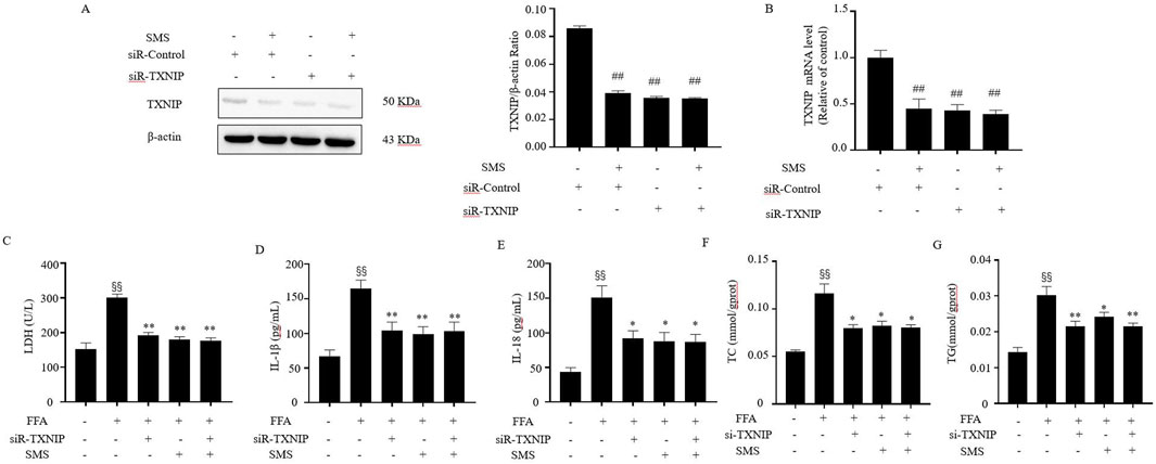 Grouped bar charts and a Western blot image showing the effects of SMS, siR-Control, and siR-TXNIP on various parameters. Panel A displays TXNIP protein levels via Western blot with a graph of TXNIP/β-actin ratio. Panels B to G show bar graphs for TXNIP mRNA level, LDH, IL-1β, IL-18, TC, and TG levels under different conditions, with statistical annotations indicating significance.