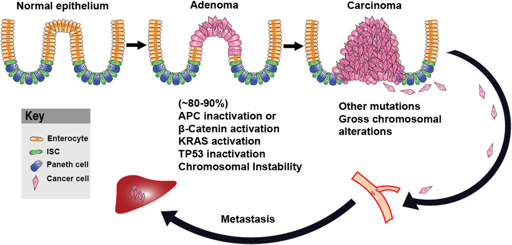 Diagram showing the progression from normal epithelium to carcinoma. The stages include normal epithelium, adenoma, and carcinoma, illustrating cellular changes. Genetic mutations listed include APC inactivation, β-catenin activation, KRAS activation, TP53 inactivation, and chromosomal instability. The process of metastasis is depicted with cancer cells spreading through the body. A key identifies cell types: enterocytes, ISCs, Paneth cells, and cancer cells.