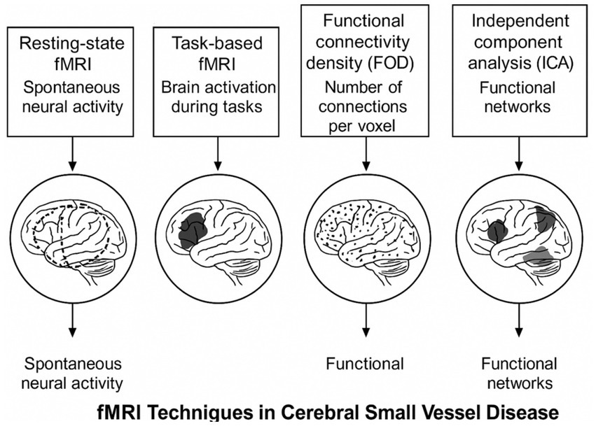 Diagram illustrating four fMRI techniques used in cerebral small vessel disease. From left to right: Resting-state fMRI for spontaneous neural activity, task-based fMRI for brain activation during tasks, functional connectivity density (FOD) showing number of connections per voxel, and independent component analysis (ICA) for functional networks. Each section includes a brain illustration corresponding to the technique described.