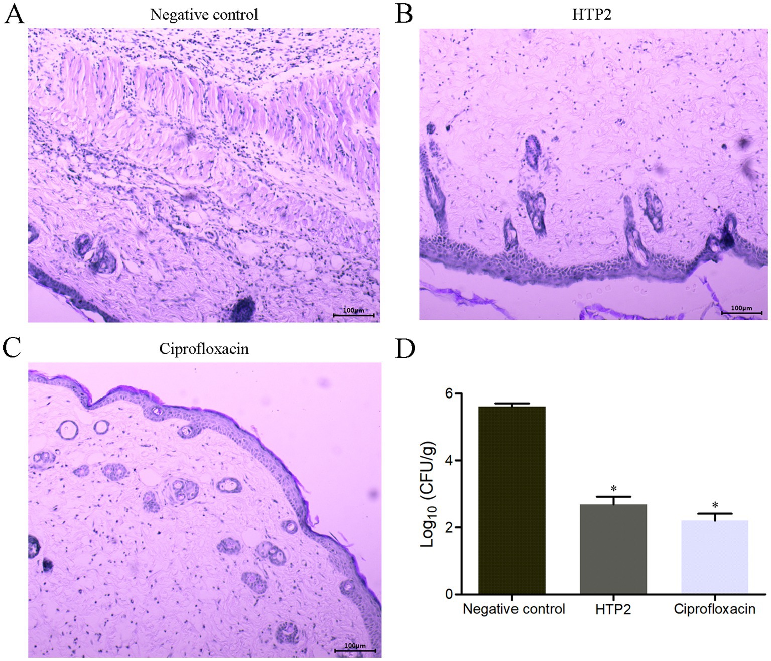 Histological images and a bar chart are displayed. Image A shows the negative control with dense tissue structure. Image B shows HTP2-treated tissue with altered cellular arrangement. Image C shows Ciprofloxacin-treated tissue with reduced cellular density. Image D presents a bar chart comparing bacterial colony-forming units (CFU) per gram, illustrating significant reductions in both HTP2 and Ciprofloxacin treatments compared to the negative control.