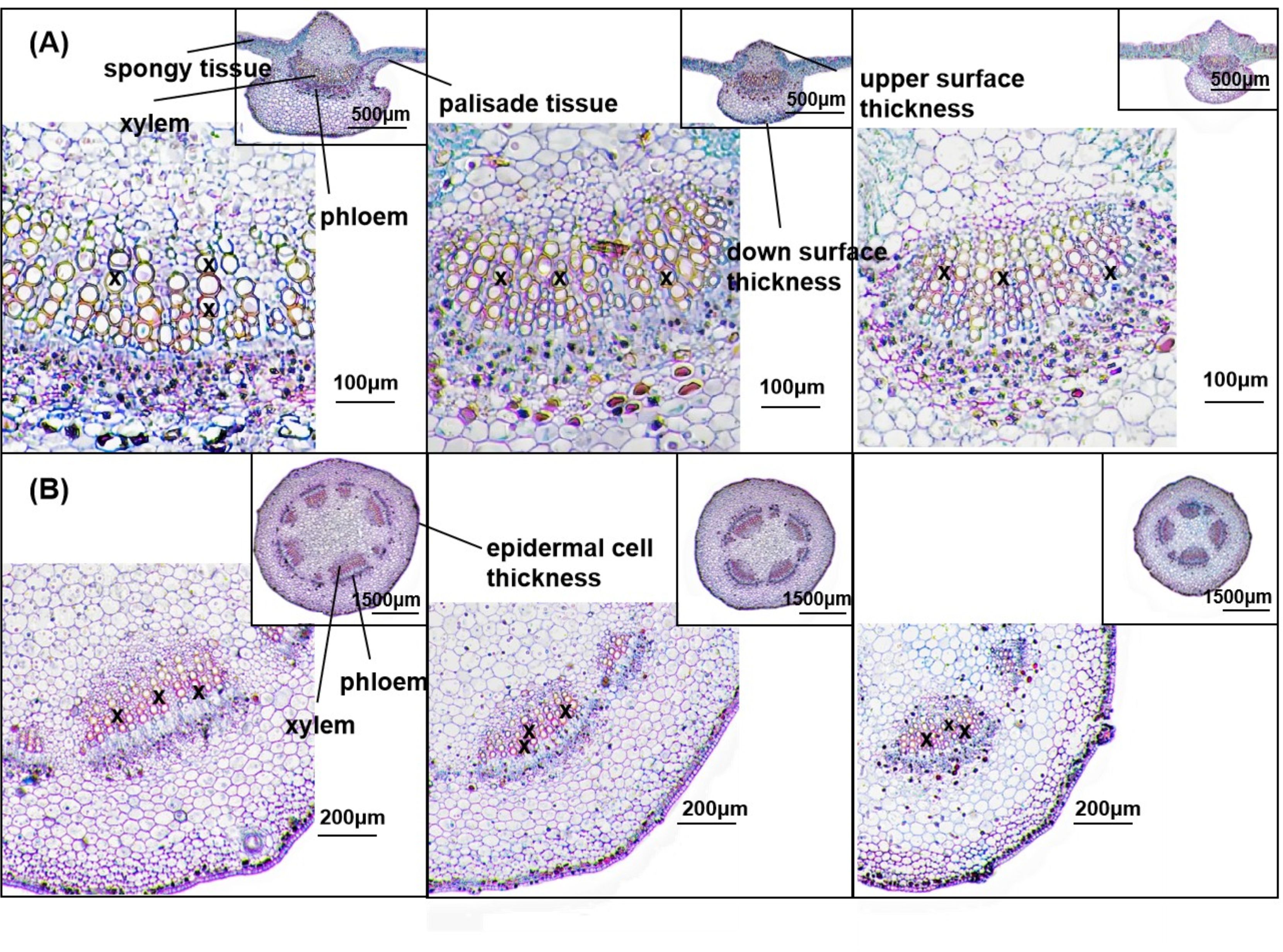 Microscopic cross-sections labeled as (A) and (B), show different plant tissues. Panel (A) highlights spongy and palisade tissue, xylem, phloem, and surface thicknesses. Panel (B) focuses on epidermal cell thickness, xylem, and phloem. Both panels include magnified insets.