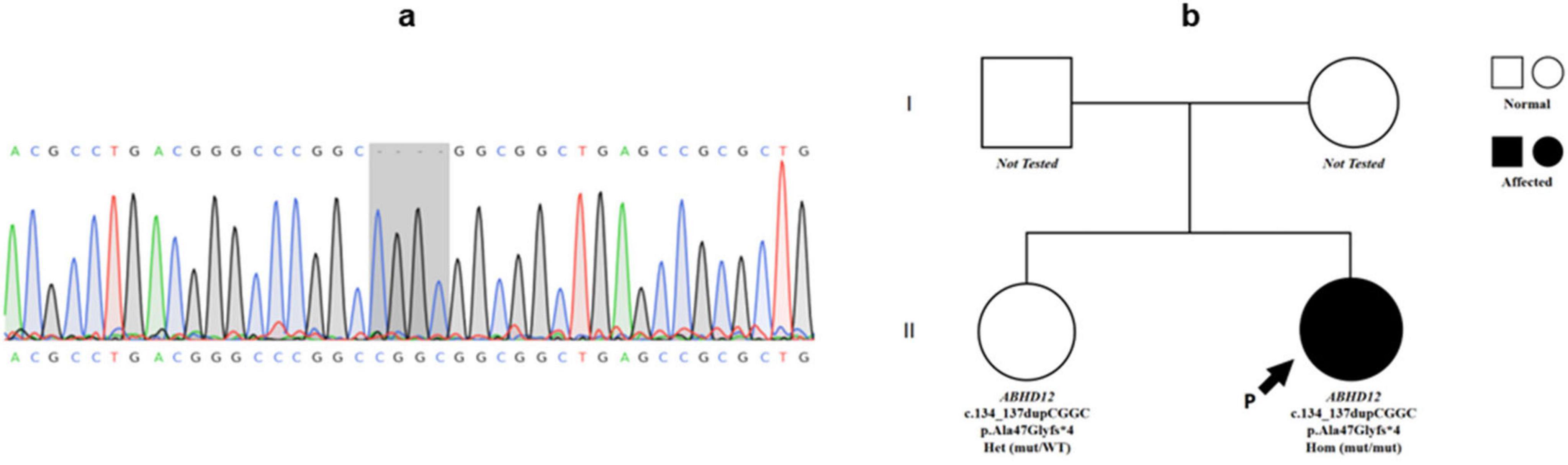 DNA sequencing chromatogram and a pedigree chart are presented. Panel (a) displays a sequencing result highlighting a specific region with a mutation. Panel (b) shows a family tree with symbols indicating gender and genetic status: squares for males and circles for females, filled for affected individuals, and empty for unaffected. The second generation includes one affected individual, with genotype information below each symbol.