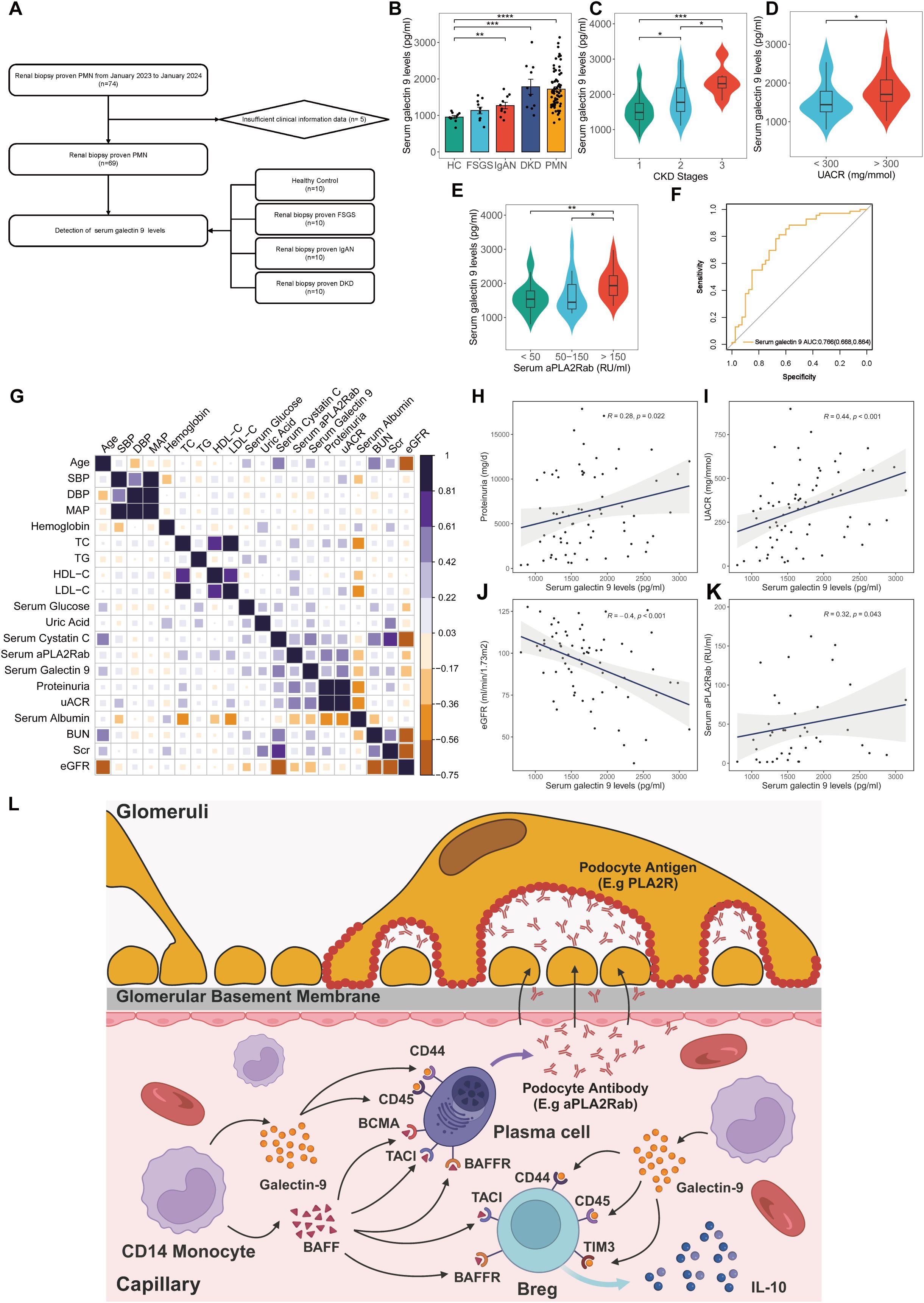 Flowchart section A outlines renal biopsy data collection and analysis. Bar and violin plots in sections B-E show serum galectin-nine levels under various conditions. Section F features an ROC curve for serum galectin-nine, and section G presents a correlation heatmap of various clinical parameters. Sections H-K display scatter plots illustrating the relationship between serum galectin-nine and other variables. Section L is a diagram showing the interaction between glomeruli and immune cells, highlighting galectin-nine’s role in kidney function.