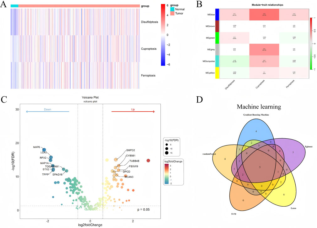 Panel A shows a heatmap comparing gene expression levels between normal and tumor groups, with a color gradient indicating expression changes. Panel B is a module-trait relationship heatmap, highlighting correlations with different module colors. Panel C is a volcano plot displaying gene expression changes, with distinct clusters of upregulated and downregulated genes indicated by color. Panel D presents a Venn diagram of machine learning models, including Gradient Boosting Machine, Xgboost, Random Forest, SVM, and Lasso, showing their shared and unique features.