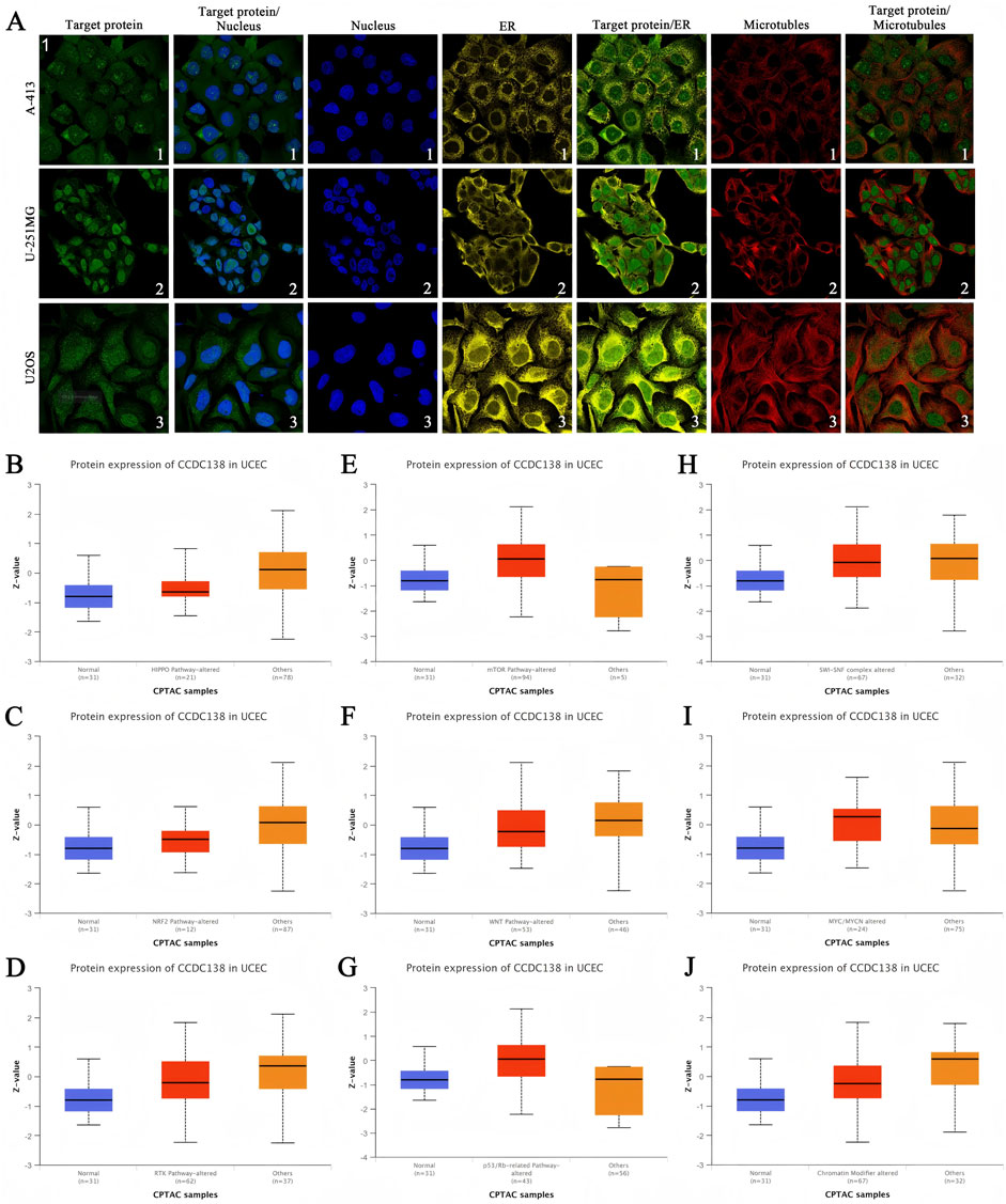 The figure consists of two sections. Section A shows fluorescent microscopic images of three different cell lines (A-431, U-251 MG, and U-2 OS) stained for target protein, nucleus, endoplasmic reticulum (ER), microtubules, and their combinations. Each row represents a cell line, and each column indicates a specific staining or overlay. Section B to J contains box plots showing the protein expression of CCDC138 in UCEC across various CPTAC samples. Each plot compares normal tissues to different pathway alterations, represented by z-values on the y-axis.