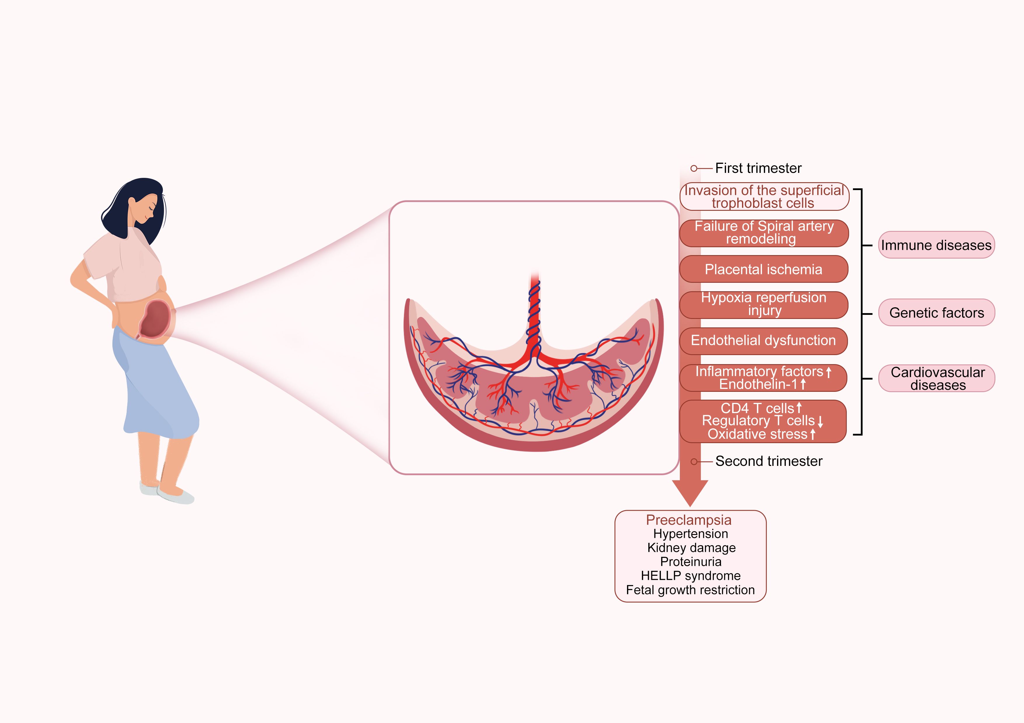 Illustration showing a pregnant woman and a cross-section of a placenta. The diagram lists first and second trimester conditions leading to preeclampsia, including immune, genetic, and cardiovascular factors. Symptoms detailed include hypertension, kidney damage, proteinuria, HELLP syndrome, and fetal growth restriction.