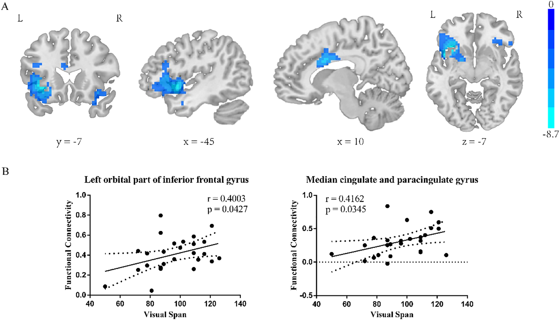 Brain imaging and scatter plots displaying functional connectivity. Part A shows brain sections with blue highlights indicating neural activation, labeled with coordinates. Part B features two scatter plots: one for the left orbital part of the inferior frontal gyrus and one for the median cingulate and paracingulate gyrus. Both plots show a positive correlation between functional connectivity and visual span, with respective correlation coefficients and p-values noted.