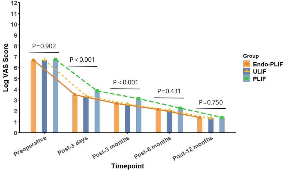 Line graph comparing lumbar VAS scores over time for three groups: Endo-PLIF (orange), ULIF (blue), and PLIF (green). The X-axis represents timepoints: preoperative, post-3 days, post-3 months, post-6 months, and post-12 months. The Y-axis shows lumbar VAS scores from zero to twelve. Scores decrease over time across all groups. Statistical significance is noted between Endo-PLIF and ULIF at post-3 days (p=0.003) and is not significant at other timepoints.