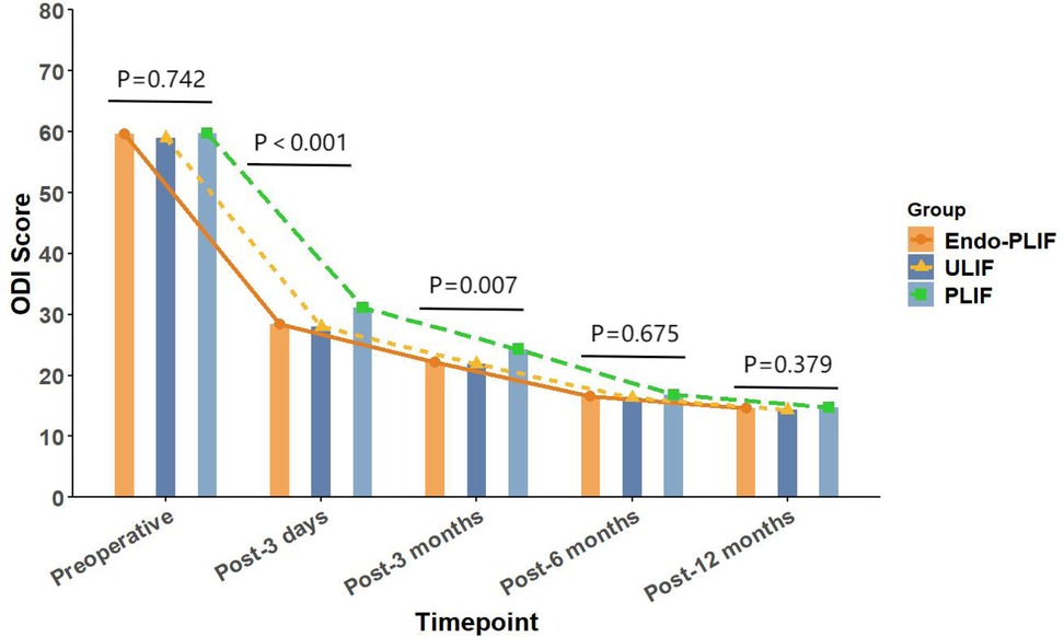 Bar graph showing Leg VAS Score over time for three groups: Endo-PLIF, ULIF, and PLIF. Scores decrease from preoperative to post-12 months, with significant differences at various time points. P-values are indicated: P=0.902 preoperative, P<0.001 post-3 days and post-3 months, P=0.431 post-6 months, and P=0.750 post-12 months.