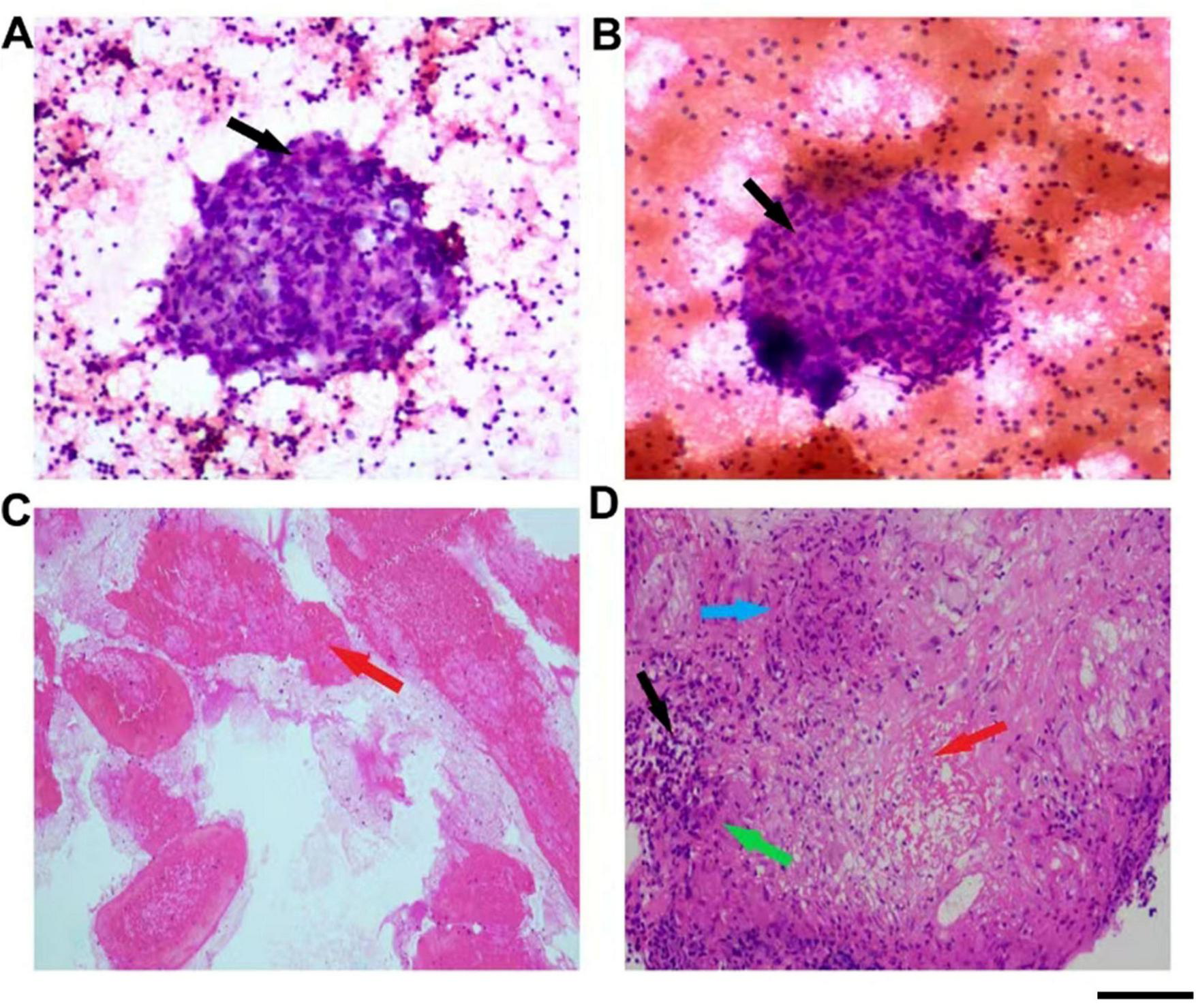 Panel A shows a purple-stained cellular cluster with a black arrow indicating a specific area. Panel B displays a similar cellular cluster under a different hue, with a black arrow identifying a focal point. Panel C features a pink-stained tissue section with a red arrow pointing to an area of interest. Panel D presents a purple-stained tissue section with black, red, blue, and green arrows highlighting distinct regions or features.