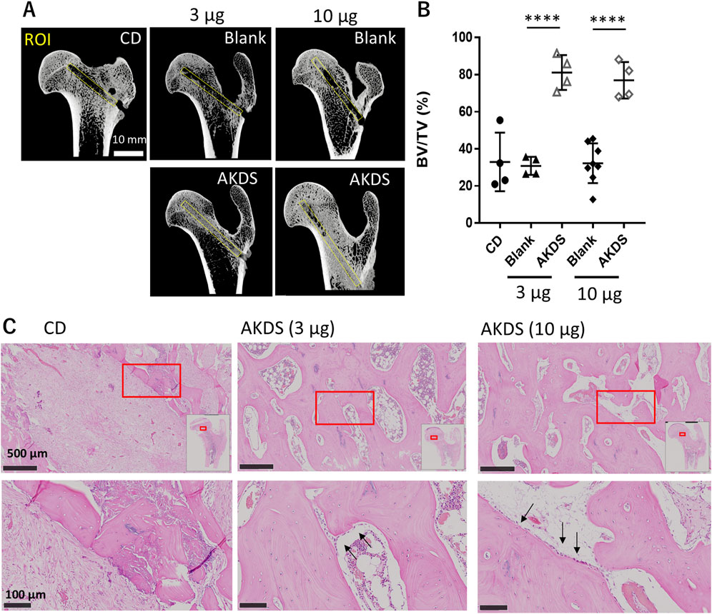 Panel A shows X-ray images of bones, highlighting regions of interest in both CD and AKDS treated samples with 3 micrograms and 10 micrograms dosages. Panel B is a graph showing bone volume fraction percentages (BV/TV%) for different treatments, indicating statistically significant differences in AKDS compared to the blank. Panel C features histological images with varying magnifications, comparing the bone structure in CD and AKDS treated groups.