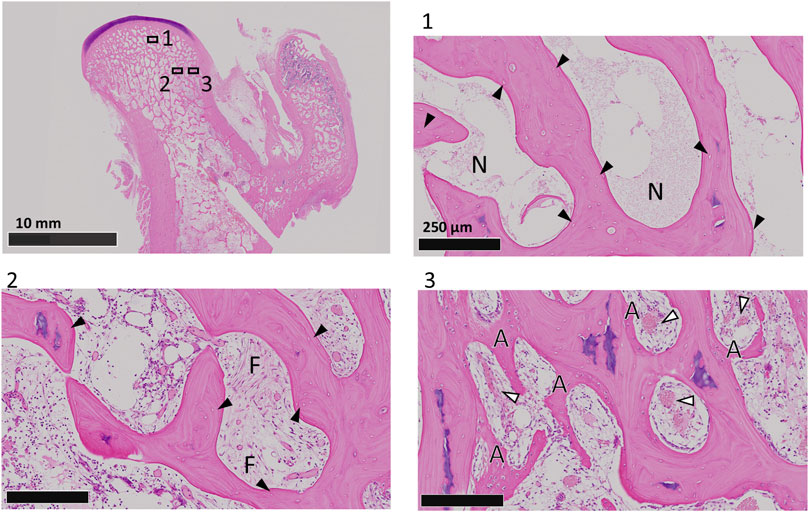 Composite image showing histological sections of tissue stained pink. The top left image displays an overview with labeled sections 1, 2, and 3 for closer inspection. Top right (1) highlights labeled areas 'N' with arrowheads indicating features at 250 micrometers scale. Bottom left (2) focuses on labeled 'F' areas with arrowheads, showing structural details. Bottom right (3) shows 'A' labeled areas, with white arrowheads marking specific points of interest at a high magnification.