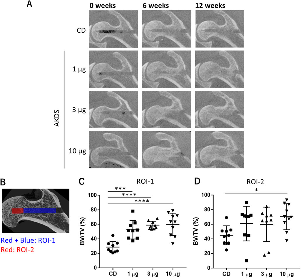 A four-panel image showing:A. CT scans of sagittal sections in four rows labeled CD, 1 µg, 3 µg, and 10 µg, over three time points: 0 weeks, 6 weeks, and 12 weeks.B. Annotation of ROI-1 and ROI-2 on an image of bone, with red and blue regions.C. Graph showing BV/TV (%) in ROI-1 for CD, 1 µg, 3 µg, and 10 µg groups with significant differences marked.D. Graph displaying BV/TV (%) in ROI-2 for the same groups with significant differences indicated.