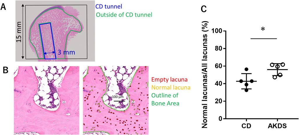 A composite image with three sections labeled A, B, and C. Section A shows a labeled microscopic cross-section of bone with a marked