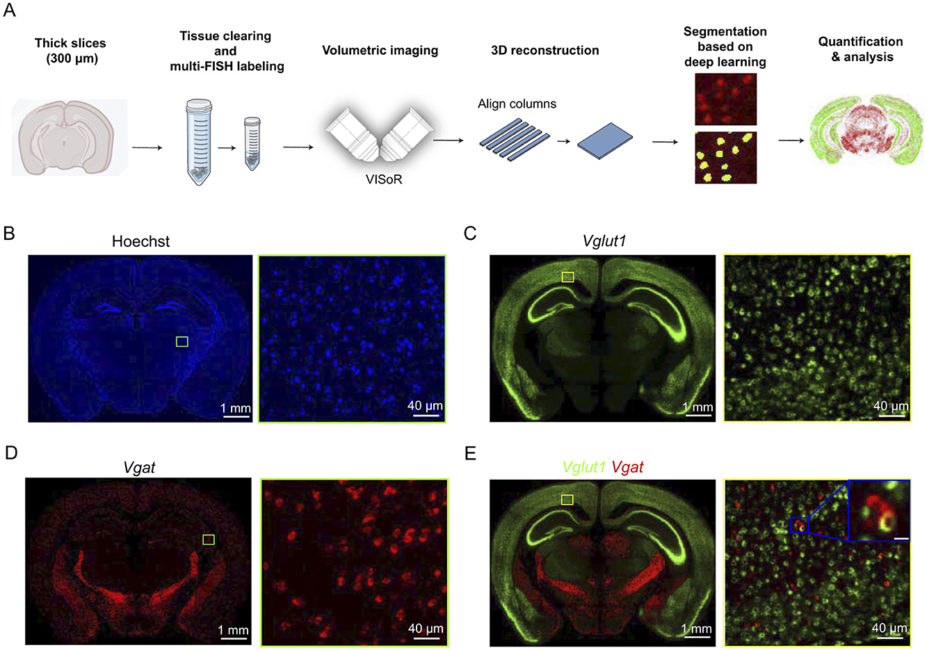 Diagram illustrating a process for analyzing brain slices. Panel A shows steps from thick slicing to quantification analysis, involving tissue clearing, imaging, 3D reconstruction, and deep learning. Panels B-E display stained brain sections labeled with Hoechst, Vglut1, and Vgat, showing different colors for each stain blue for Hoechst, green for Vglut1, red for Vgat, and a combination in panel E. Each panel includes a zoomed-in view highlighting detailed staining patterns.