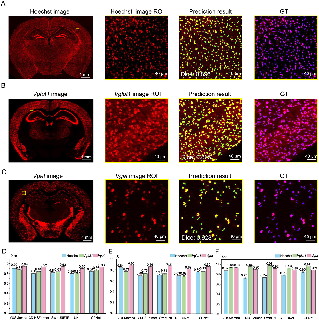 Three panels show comparative data of Vglut1 and Vgat expressions in brain regions SSp-bfd, BMAp, and CA1. Each panel includes a colored brain section image (green for Vglut1 and red for Vgat) labeled A, D, G; a bar graph with density counts labeled B, E, H; and a pie chart showing expression percentages labeled C, F, I. The data reveals varying densities and proportions in each region, with Vglut1 being dominant in green and Vgat in red.