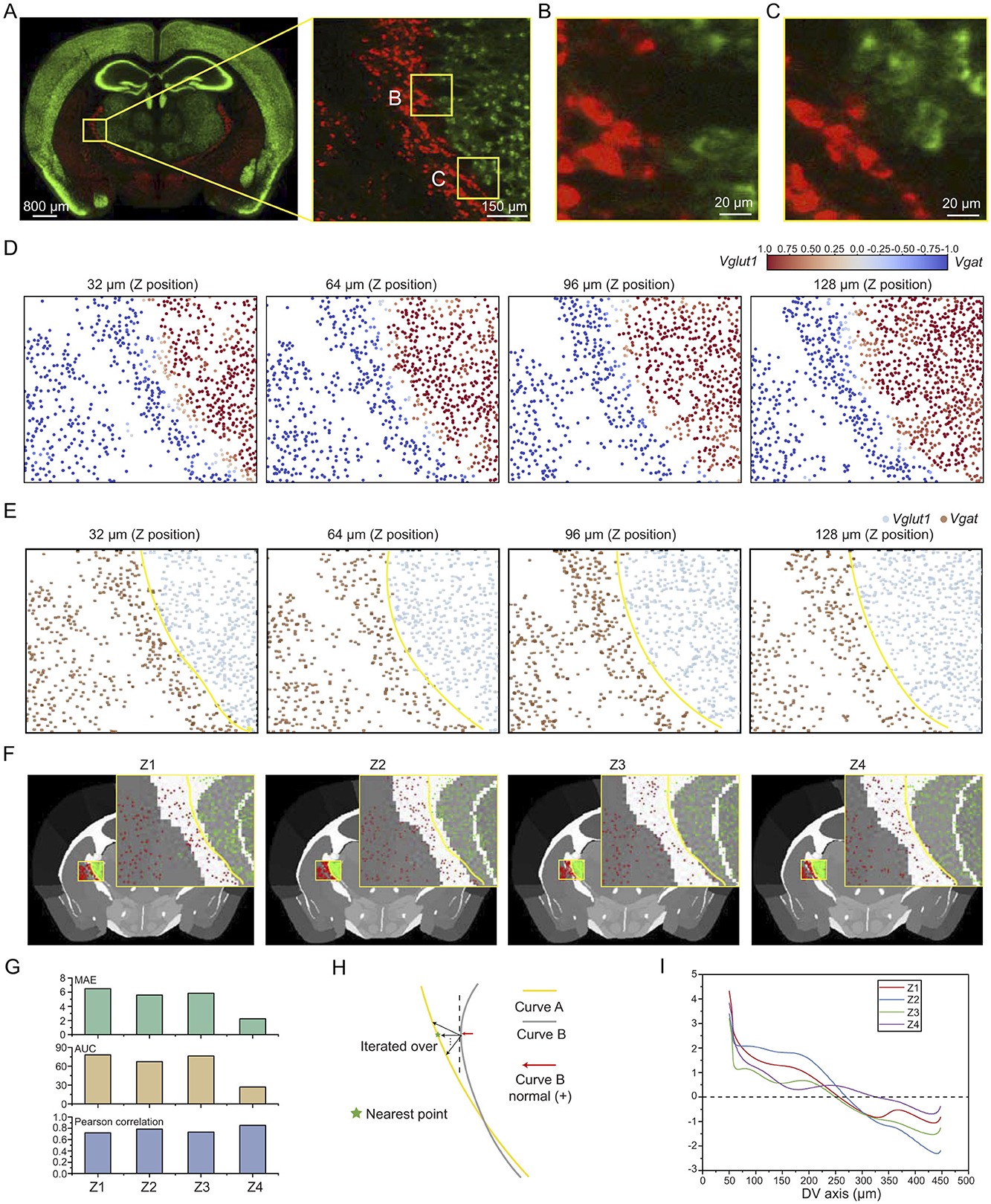 Multi-panel image showing brain sections and data visualizations. Panel A displays a brain section with highlighted areas B and C. Panels B and C show close-up images of cells stained with red and green markers. Panels D and E depict scatter plots showing data distribution at various Z positions with red and blue or brown and blue dots. Panel F presents four images (Z1-Z4) of brain sections with insets analyzing specific areas. Panel G includes bar charts comparing various statistical measures across Z1-Z4. Panel H illustrates a schematic with curves labeled A and B, showing iteration and nearest points. Panel I presents line graphs of DV axis data across Z1-Z4.