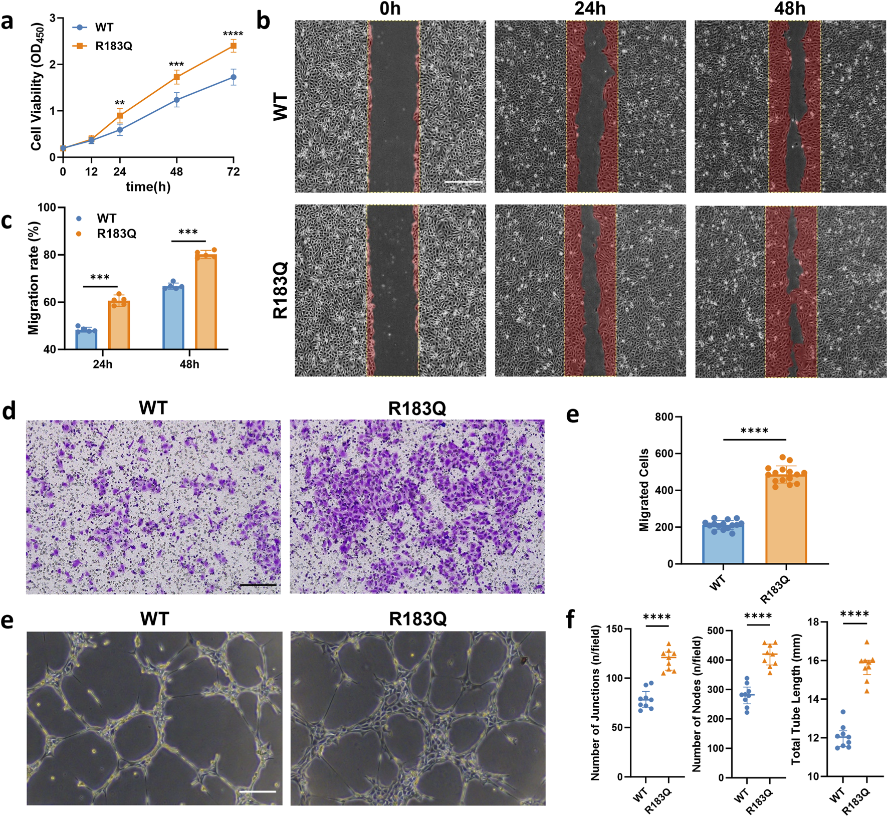 Panel (a) shows a line graph of cell viability over 72 hours comparing WT and R183Q. Panel (b) includes images of cells at 0, 24, and 48 hours, illustrating migration. Panel (c) presents a bar graph of migration rates at 24 and 48 hours. Panel (d) displays stained cell images for WT and R183Q. Panel (e) shows cell morphology images comparing WT and R183Q. Panel (f) contains three bar graphs comparing the number of junctions, nodes, and total tube length, with significant differences noted in R183Q.