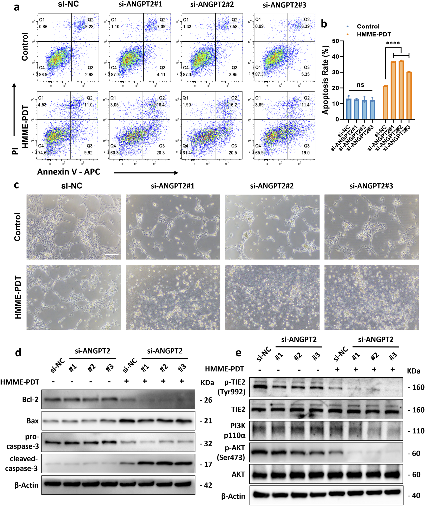 Flow cytometry and microscopy data alongside protein expression analysis for si-NC and si-ANGPT2 treated cells with or without HMME-PDT. Panel (a) shows scatter plots indicating apoptosis levels using Annexin V and PI staining. Panel (b) presents a bar graph comparing apoptosis rates, with significant differences indicated. Panel (c) includes micrographs displaying cellular morphology under control and HMME-PDT conditions. Panels (d) and (e) depict Western blots for proteins like Bcl-2, Bax, TIE2, PI3K, and AKT, highlighting molecular changes post-treatment.
