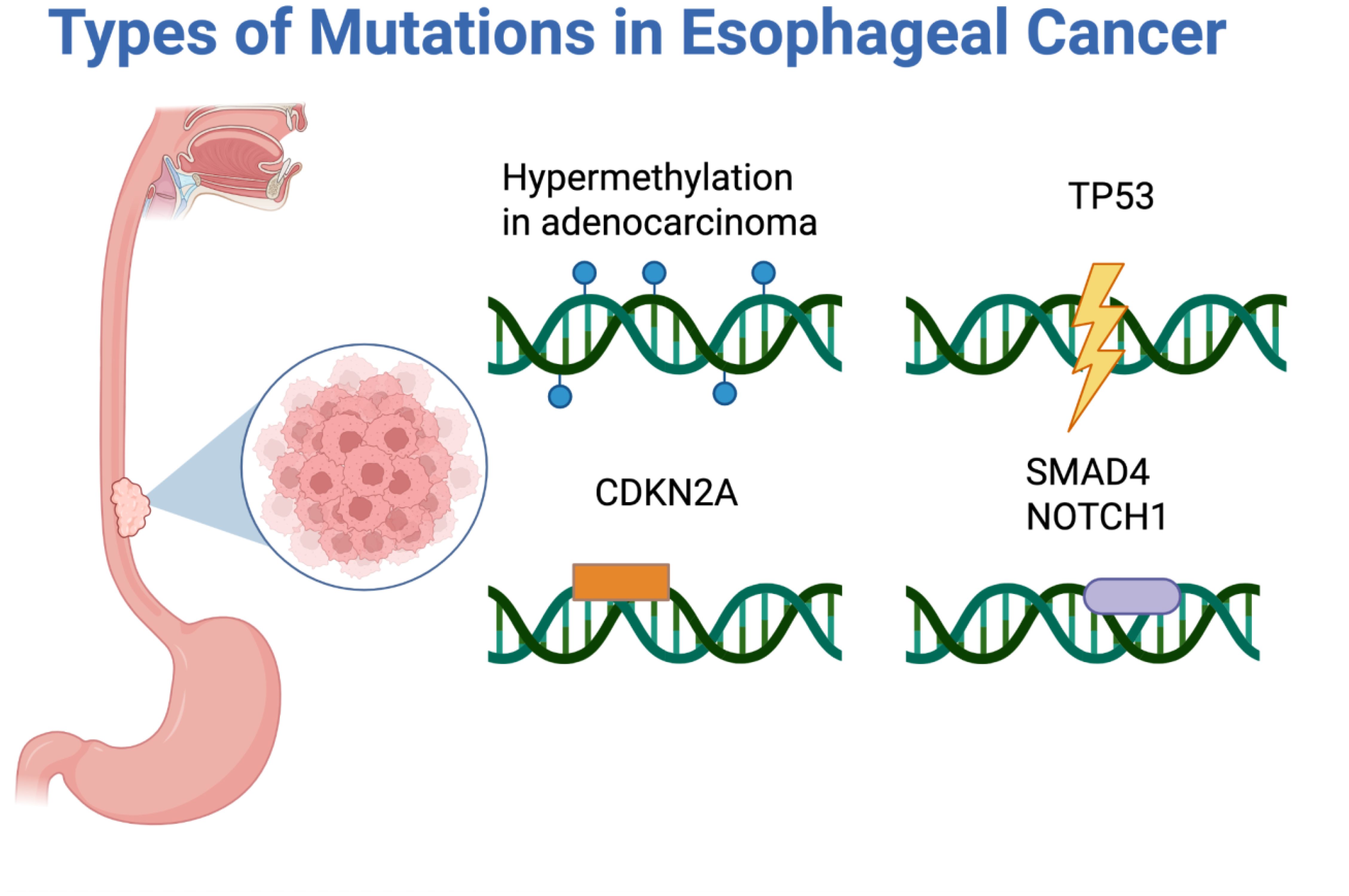 Diagram showing types of mutations in esophageal cancer, including hypermethylation in adenocarcinoma, CDKN2A, TP53 with lightning bolt, and SMAD4 and NOTCH1. An esophagus illustration with a tumor is on the left.