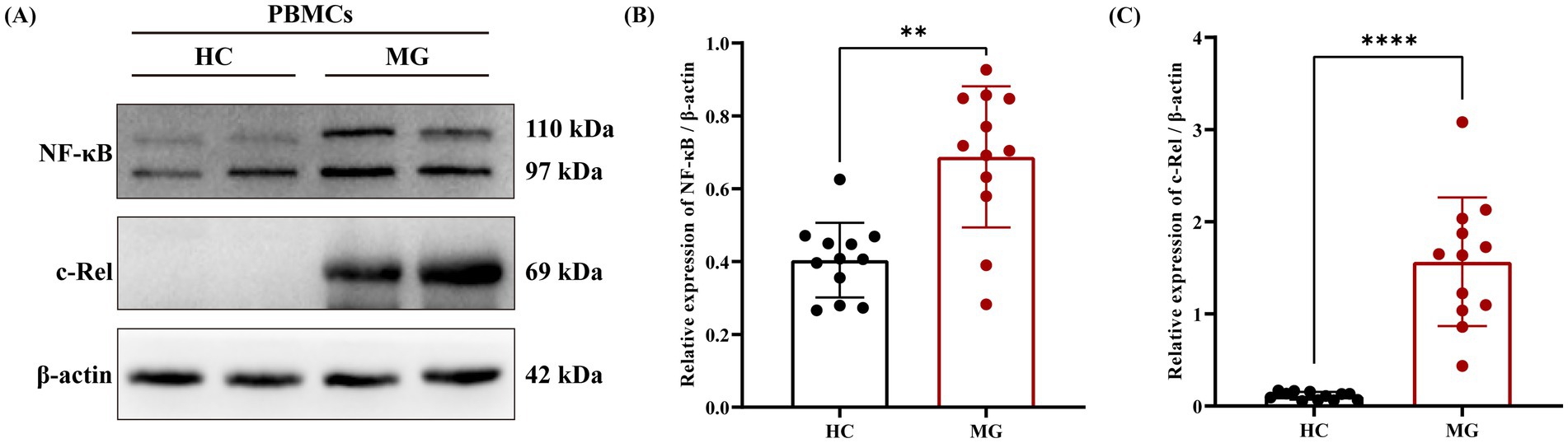 Western blot and bar graphs comparing protein expression in peripheral blood mononuclear cells (PBMCs) between healthy controls (HC) and individuals with myasthenia gravis (MG). The blot shows expression levels of NF-kB, c-Rel, and β-actin. NF-kB and c-Rel expression is higher in MG compared to HC. Bar graphs (B) and (C) indicate significant differences in the relative expression levels of NF-kB and c-Rel in MG versus HC, with statistical significance denoted by asterisks.