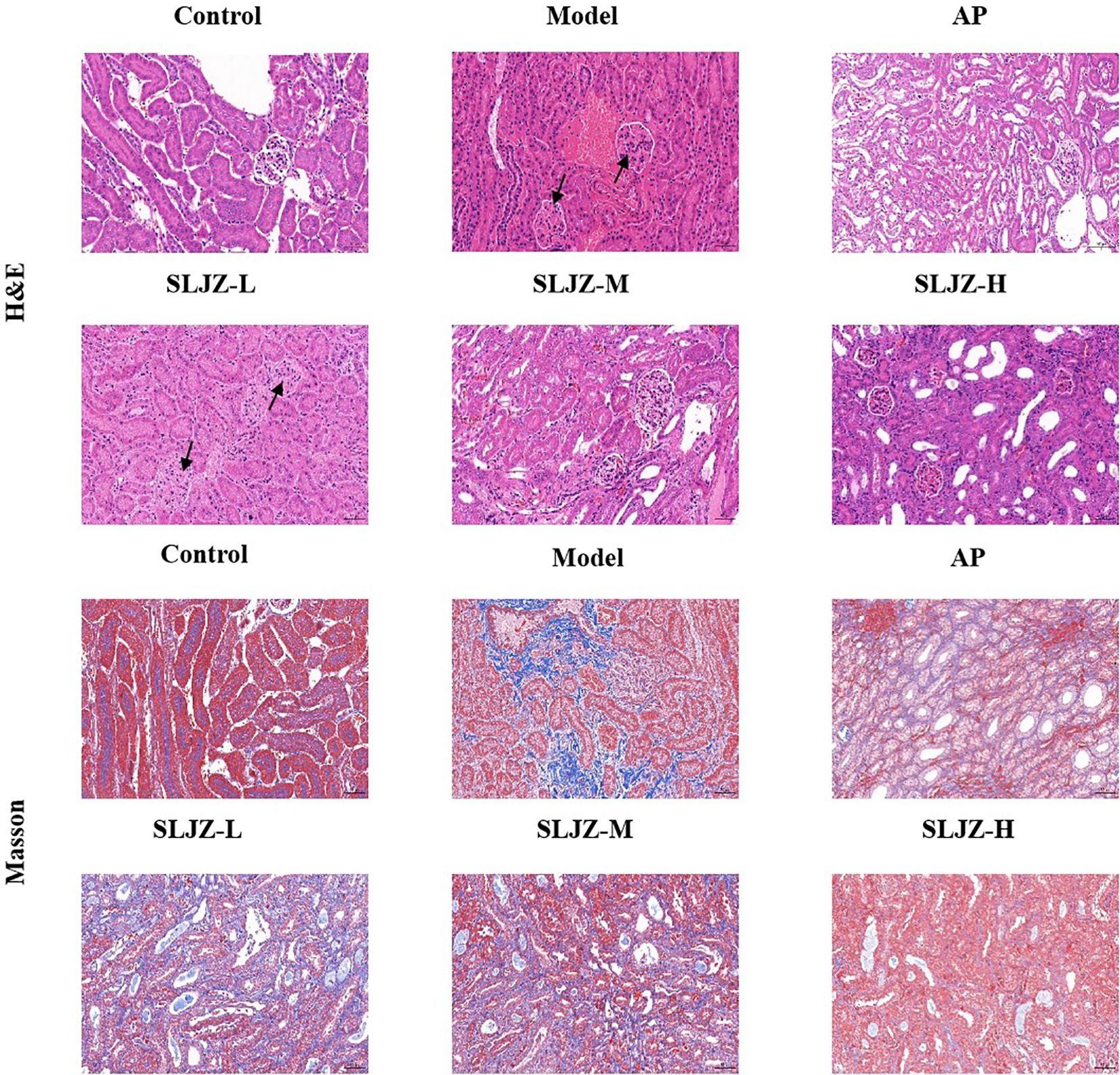 Histological image set showing six panels of tissue samples stained with Hematoxylin and Eosin (H&E) and Masson's trichrome. The top row displays H&E-stained samples labeled Control, Model, and AP alongside SLJZ-L, SLJZ-M, and SLJZ-H. The bottom row shows corresponding Masson-stained samples. Each sample depicts varying histological features, indicated by differences in staining intensity and tissue structure.