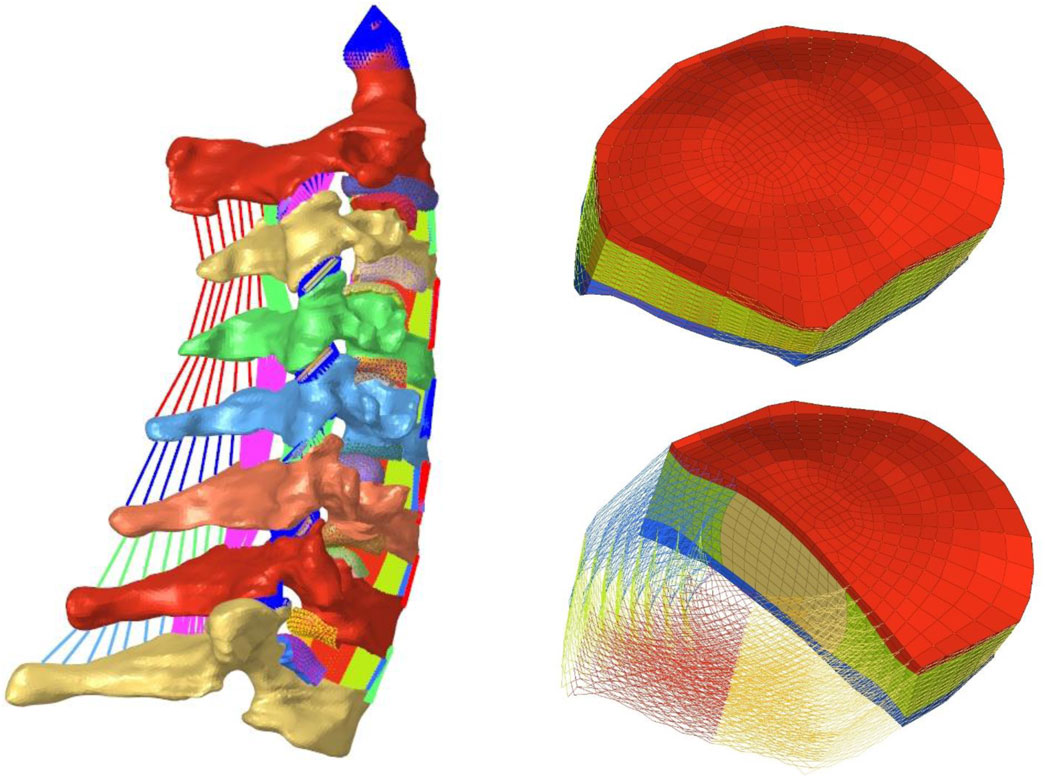 Three-dimensional renderings of spinal vertebrae and intervertebral discs. On the left, a color-coded lateral view of the spine shows distinct vertebrae. On the right, two cross-sections of intervertebral discs display layered structures in red, yellow, and blue, demonstrating internal composition and curvature.