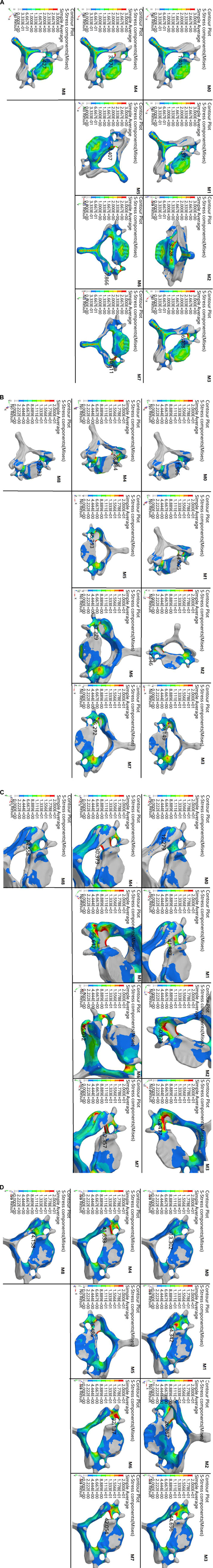 Contour plots illustrating stress components (Mises) on a bone structure across different conditions labeled M0 to M8. Each plot shows a color gradient from red to blue, indicating stress levels, with corresponding numerical values displayed. Contour plots displaying stress components marked by color variations (from blue to red), indicating stress levels on eight different vertebral models labeled M8, M4, M0, M5, M1, M6, M2, and M3. Each model shows distinct stress concentrations, with numeric values annotating specific points of interest. Grid of contour plots showcasing stress components (Mises) on a bone structure. Colors range from blue (low stress) to red (high stress). Each plot, labeled M0 to M8, displays varying stress distributions. Contour plots showing stress components (Mises) for eight different models labeled M0 to M7. Each model displays variations in stress distribution with a color gradient from blue (low stress) to red (high stress). Numerical values indicate specific stress points, such as 47.158 for M8 and 54.342 for M1.