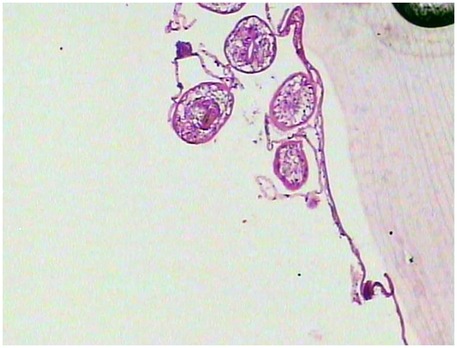 Microscopic view of a strobila from a tapeworm specimen, showing several sections of its segmented body. The image displays the internal structures with a purple stain, highlighting the reproductive organs within each segment.