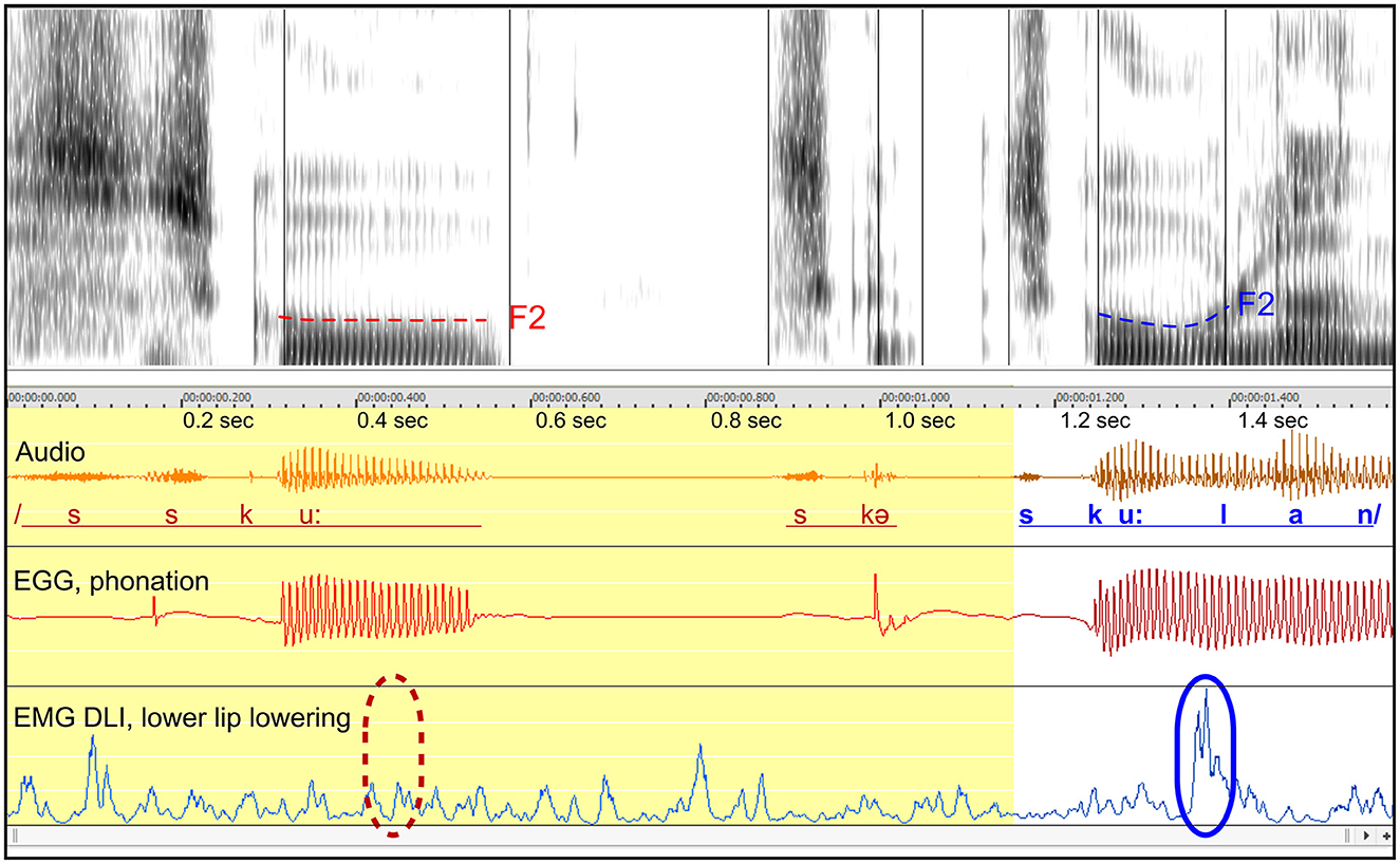 Spectrogram and waveform analysis of a phonetic sequence showing formant transitions for /sku:lan/. The top panel displays a spectrogram with F2 formants marked in red and blue. Below, waveforms of audio, EGG phonation, and EMG lower lip lowering are illustrated. Time markers indicate speech segments from 0 to 1.6 seconds.