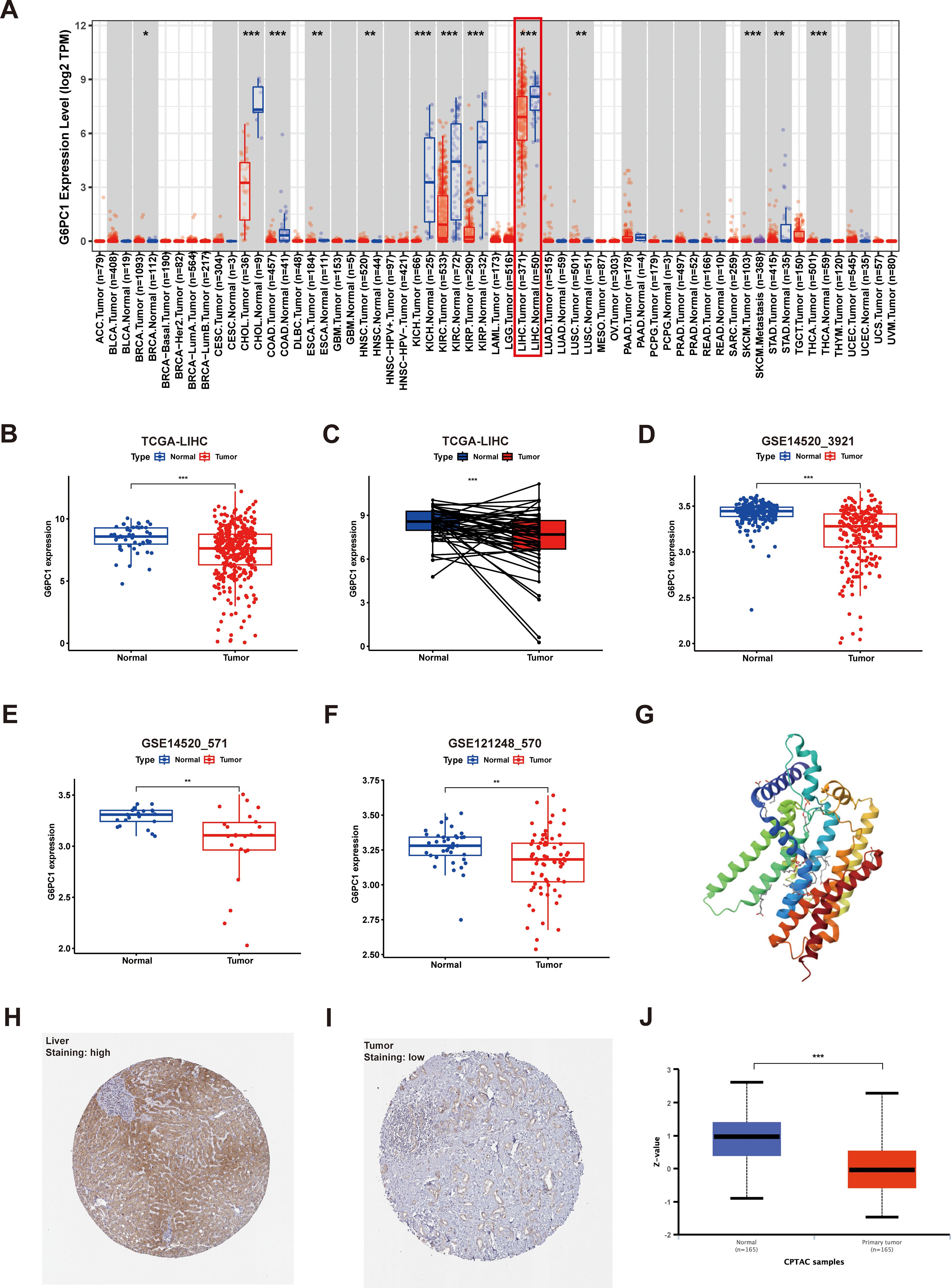 Panel A shows a box plot of G6PC1 expression levels across various cancer types, indicating significant differences. Panels B to F display box plots with normal and tumor comparisons for G6PC1 expression in different datasets, consistently showing higher expression in tumors. Panel G illustrates a ribbon diagram of a protein structure. Panels H and I are histological images of liver tissue, highlighting high and low staining levels, respectively. Panel J presents a box plot comparing z-values between normal and primary tumor samples, revealing significant differences.