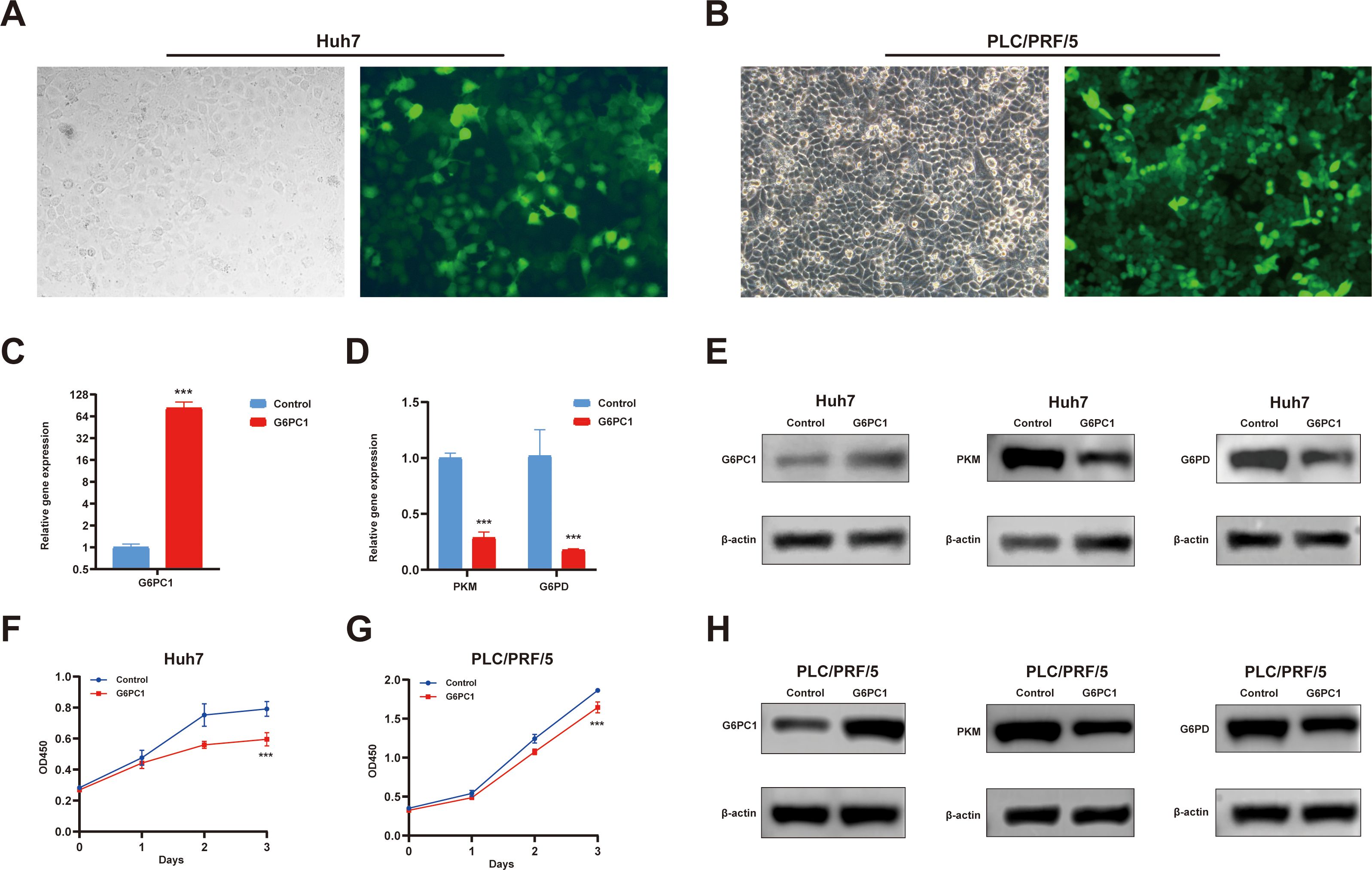 Panels display various analyses of Huh7 and PLC/PRF/5 cell lines. (A) Fluorescent and bright-field images show cell morphology and gene expression. (B) Additional cell images highlight differences in gene expression. (C) Bar graph indicates significant increase in G6PC1 expression in treated cells. (D) Bar graph shows reduction in PKM and G6PD expression in treated cells. (E, H) Western blots reveal protein levels for G6PC1, PKM, and G6PD compared to β-actin as a control in Huh7 and PLC/PRF/5 cells. (F, G) Line graphs depict cell growth over three days, comparing control and G6PC1-treated groups.