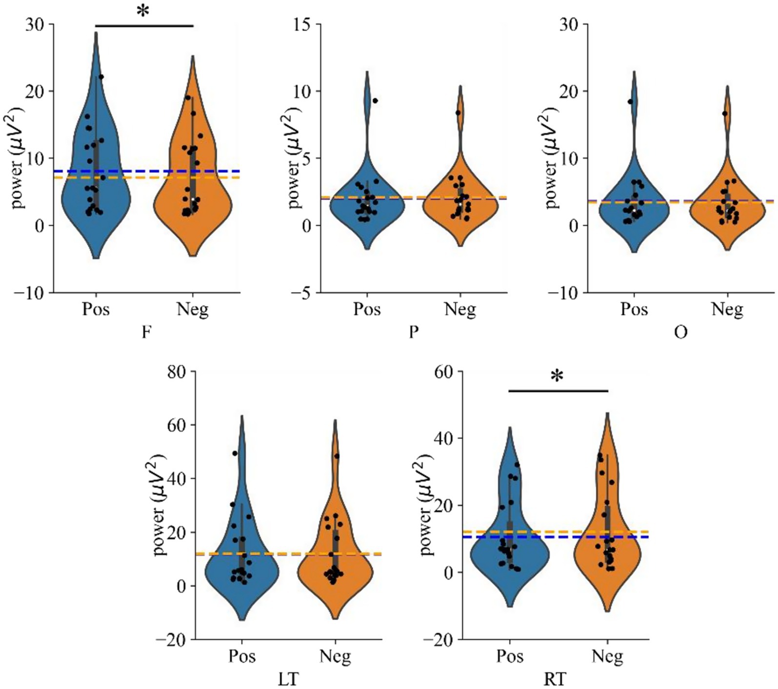 Five violin plots display power values (microvolts squared) for positive (Pos) and negative (Neg) conditions in frontal (F), parietal (P), occipital (O), and left (LT) and right temporal (RT) regions. Blue and orange colors differentiate conditions. The F and RT plots show significant differences with asterisks and horizontal lines. Dotted lines indicate mean values.