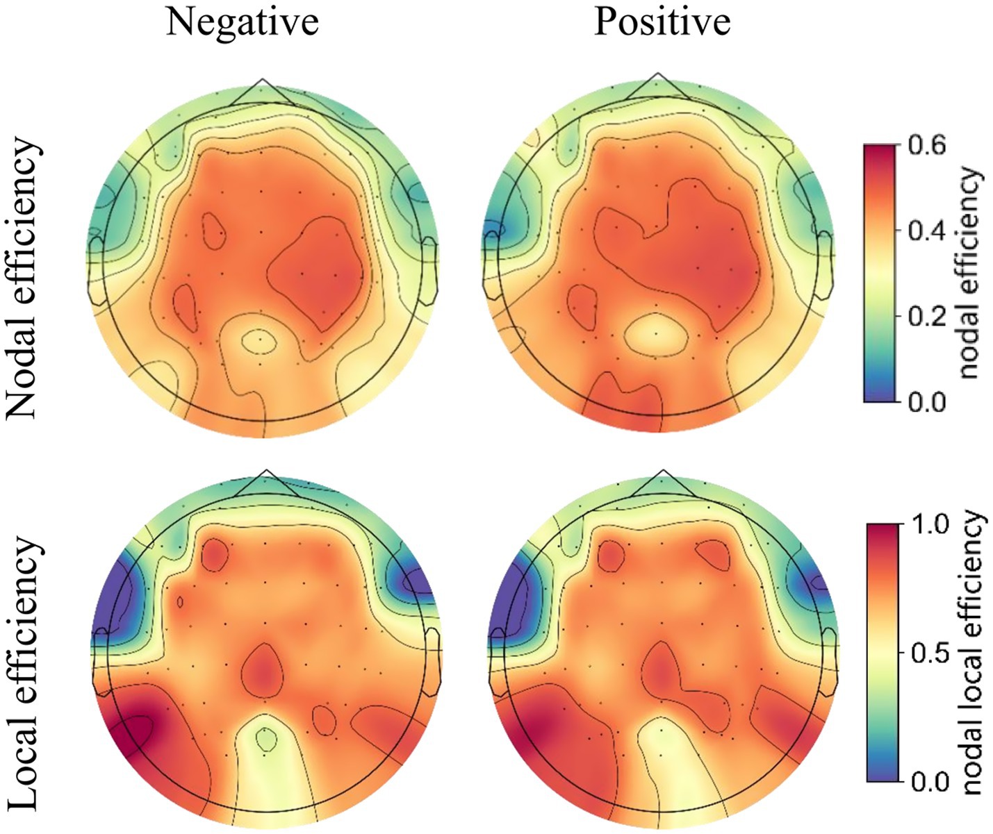 Topographic brain maps displaying nodal and local efficiency for negative and positive conditions. The maps use a color scale from blue to red, signifying lower to higher efficiency levels, with contours indicating gradations.