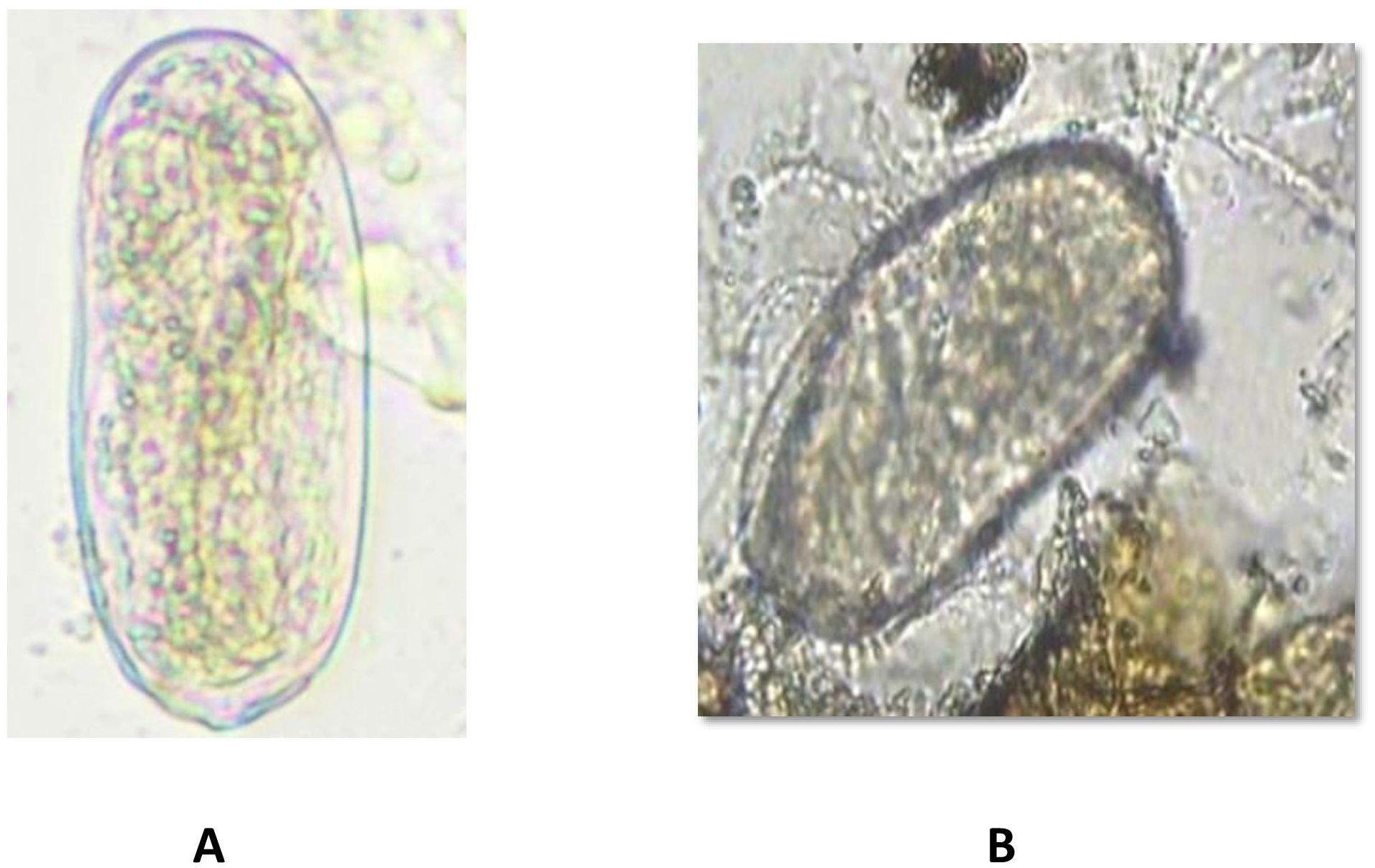Image A shows an oval-shaped microscopic structure with a textured, colorful internal pattern and a clear outline. Image B displays a similar oval structure with a more blurred appearance against a granular background. Both images are labeled A and B.