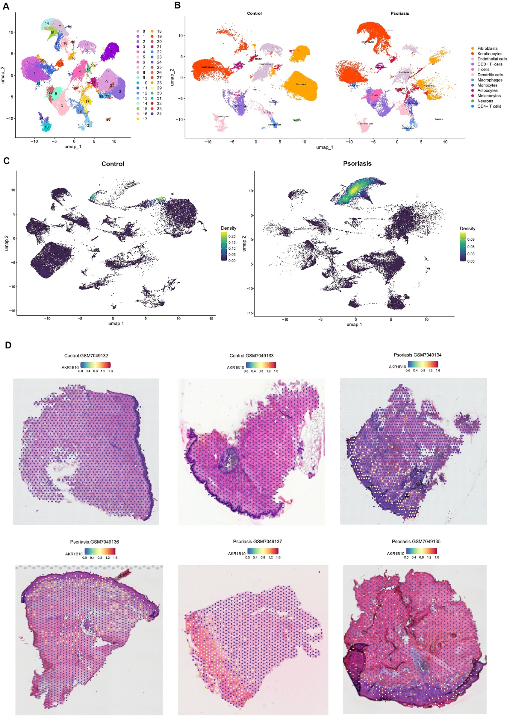 Panel A presents a UMAP visualization of cell types from skin samples, color-coded by cluster. Panel B contrasts UMAP plots of control and psoriasis samples, highlighting distinct cell distributions. Panel C shows density plots of control and psoriatic skin, with a color gradient indicating cell density. Panel D comprises six histological images of skin samples, with grayscale overlays indicating AKR1B10 expression levels. Each biopsy, from either control or psoriatic skin, shows varying intensities of purple to pink staining.